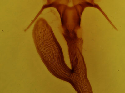 genitalia view of adult Leucania linda