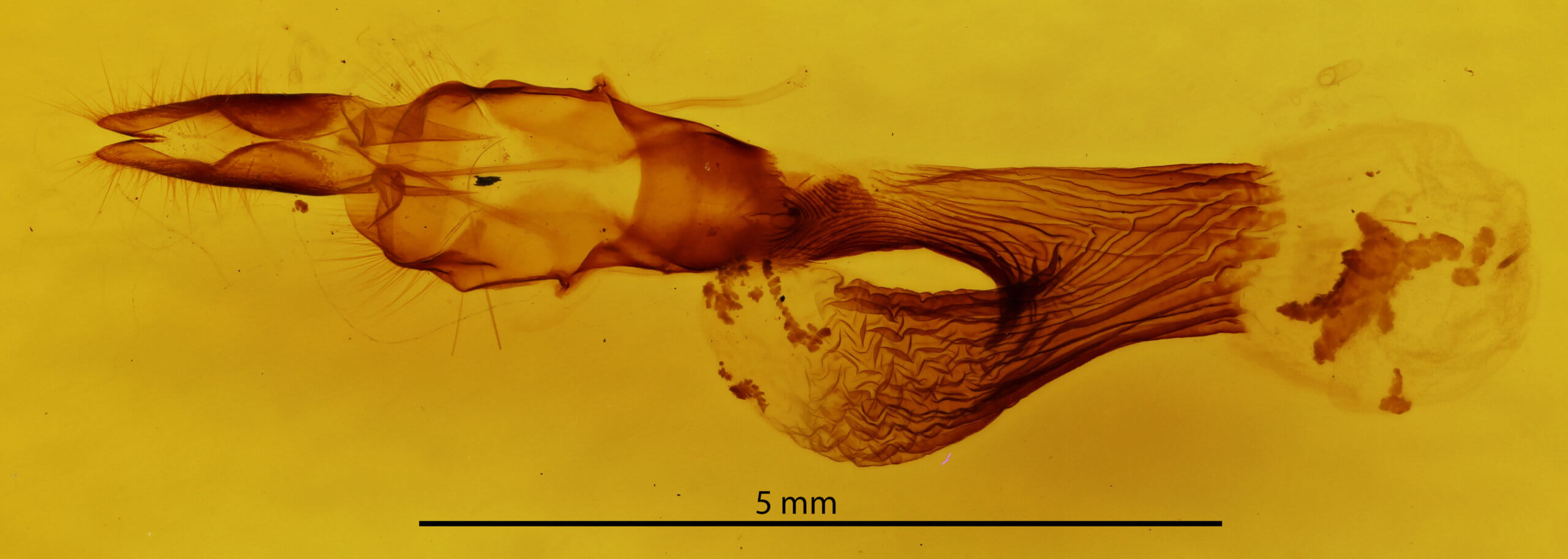 genitalia view of adult Leucania multilinea
