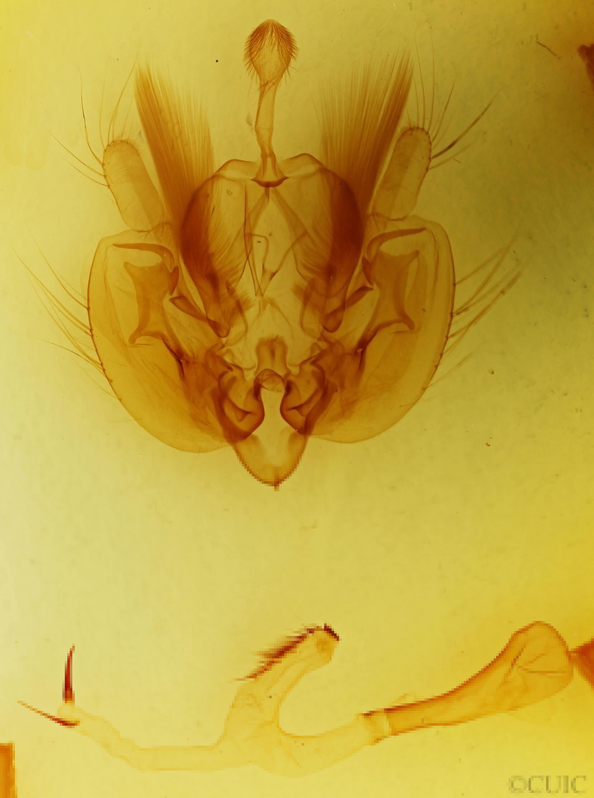 genitalia view of adult Leucania pseudargyria