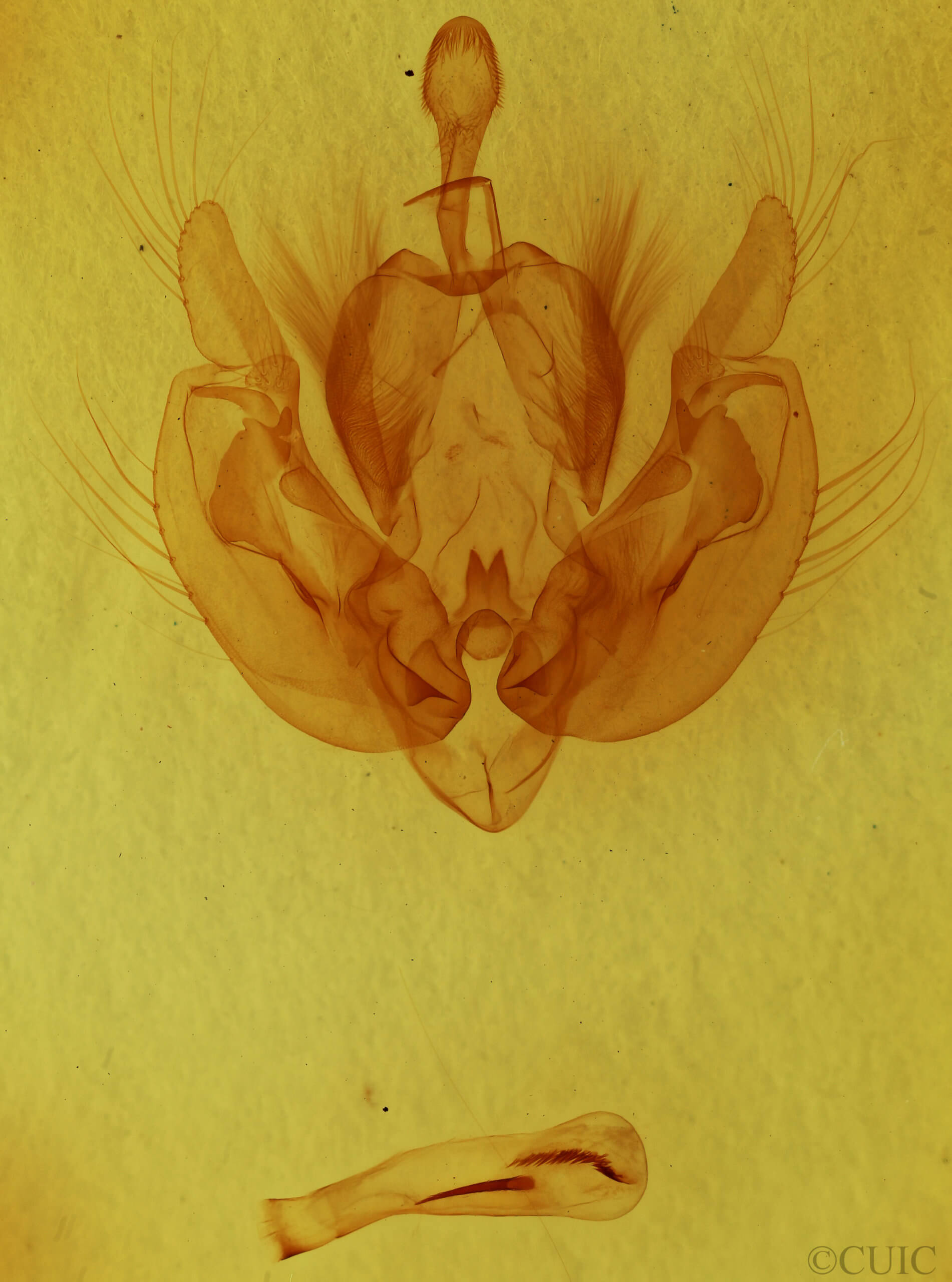 genitalia view of adult Leucania ursula