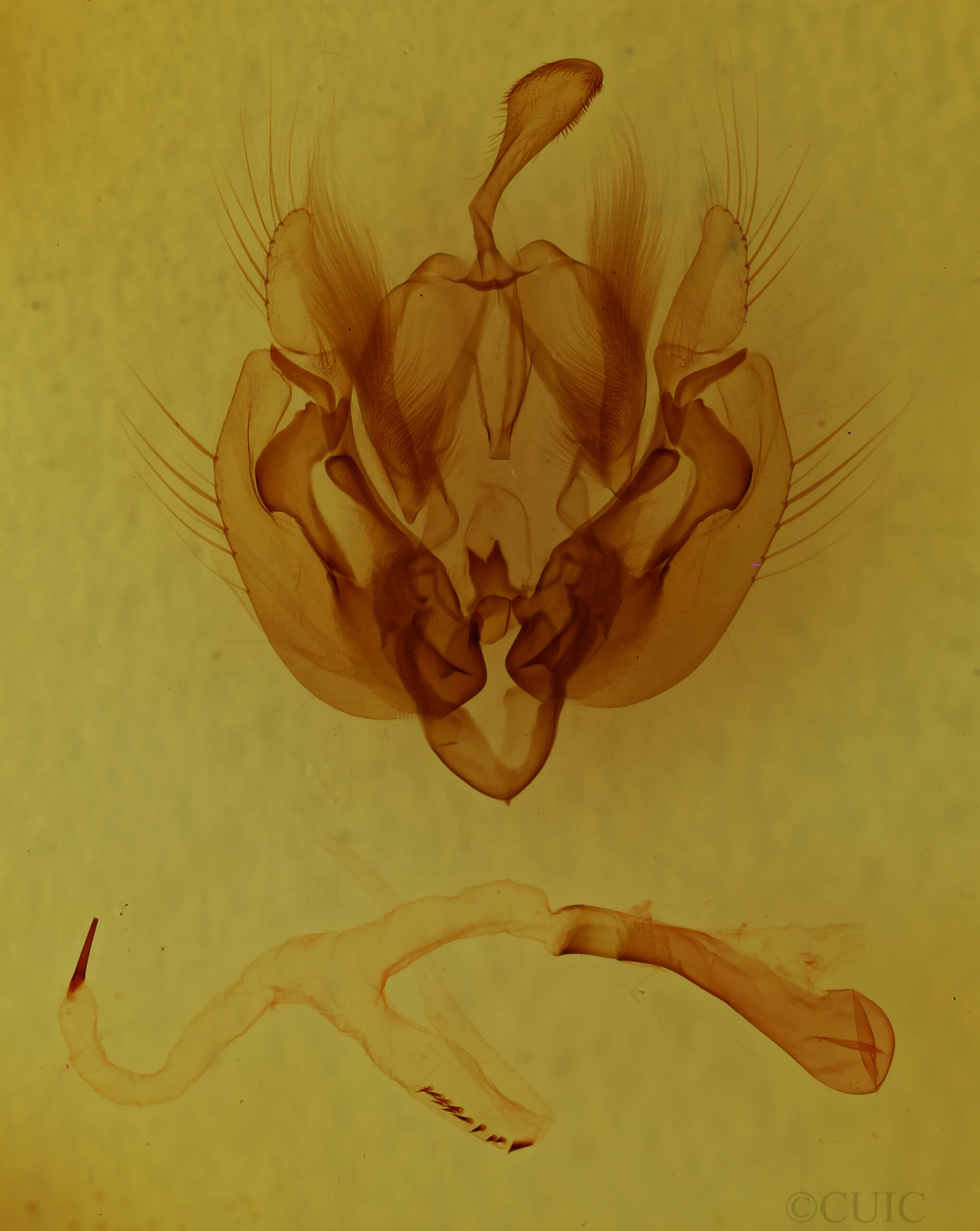 genitalia view of adult Leucania ursula