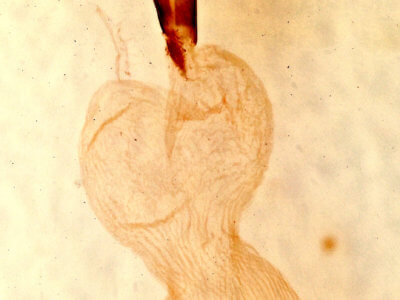 genitalia view of adult Lithophane consocia
