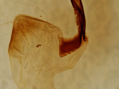 genitalia view of adult Lithophane semibrunnea