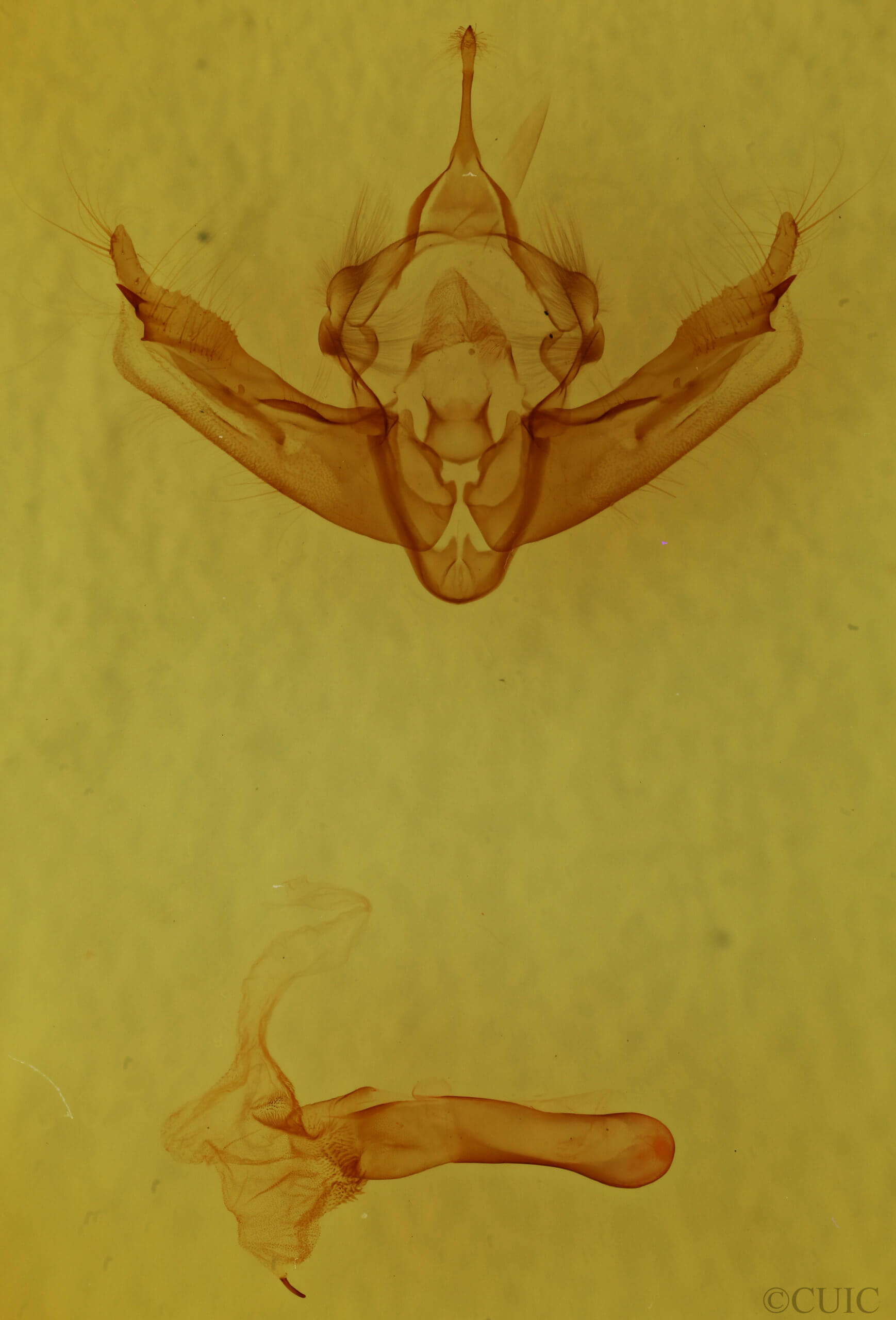 genitalia view of adult Resapamea stipata