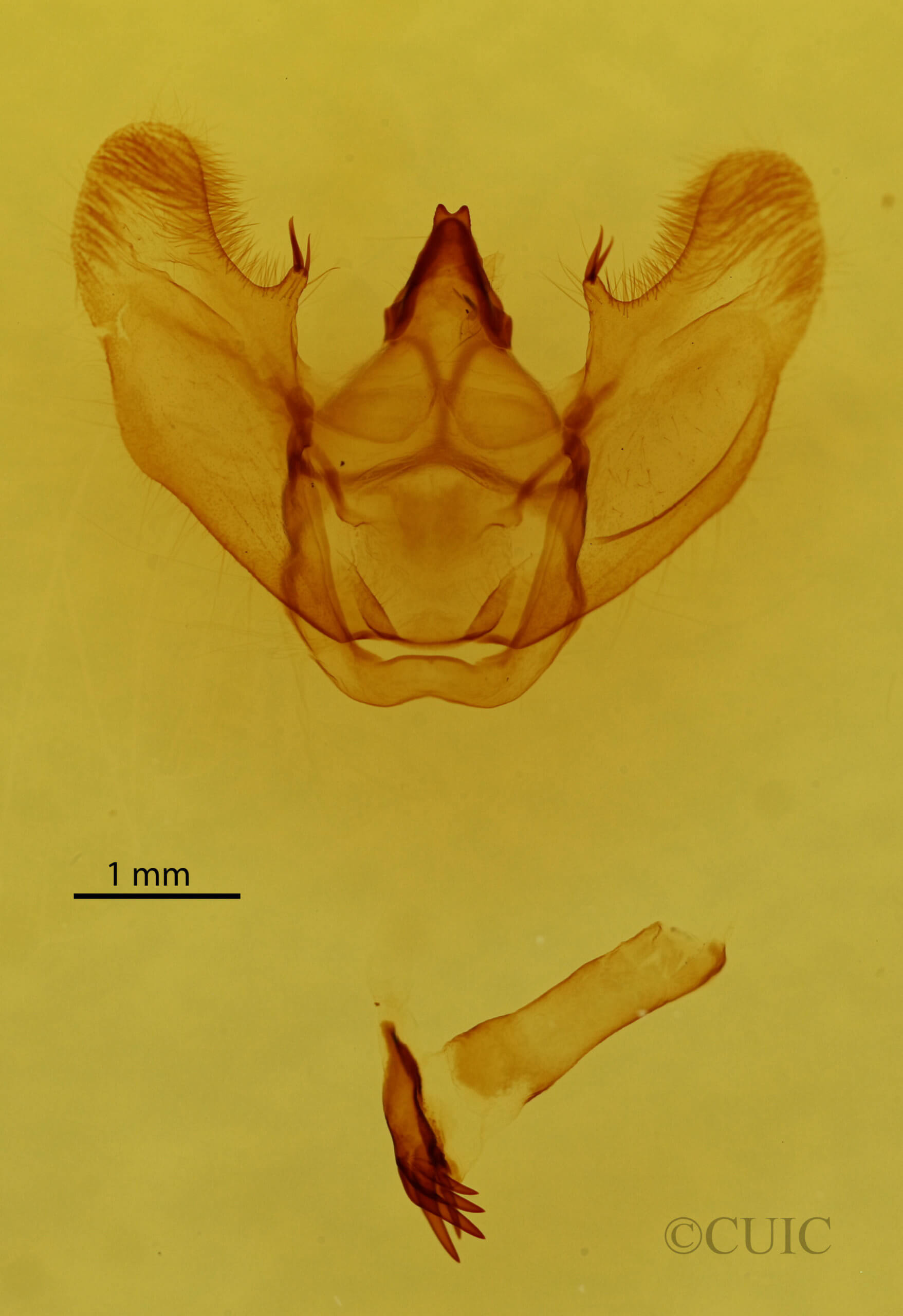 genitalia view of adult Lytrosis sinuosa