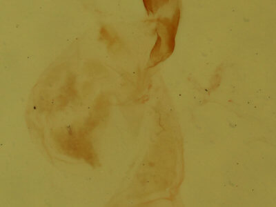 genitalia view of adult Meganola minuscula