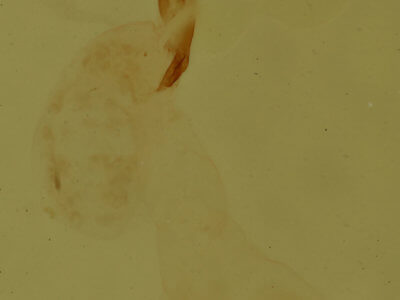 genitalia view of adult Meganola minuscula