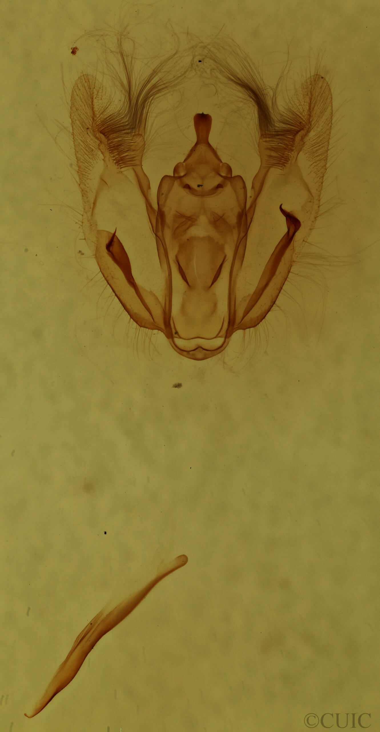 genitalia view of adult Melanolophia canadaria