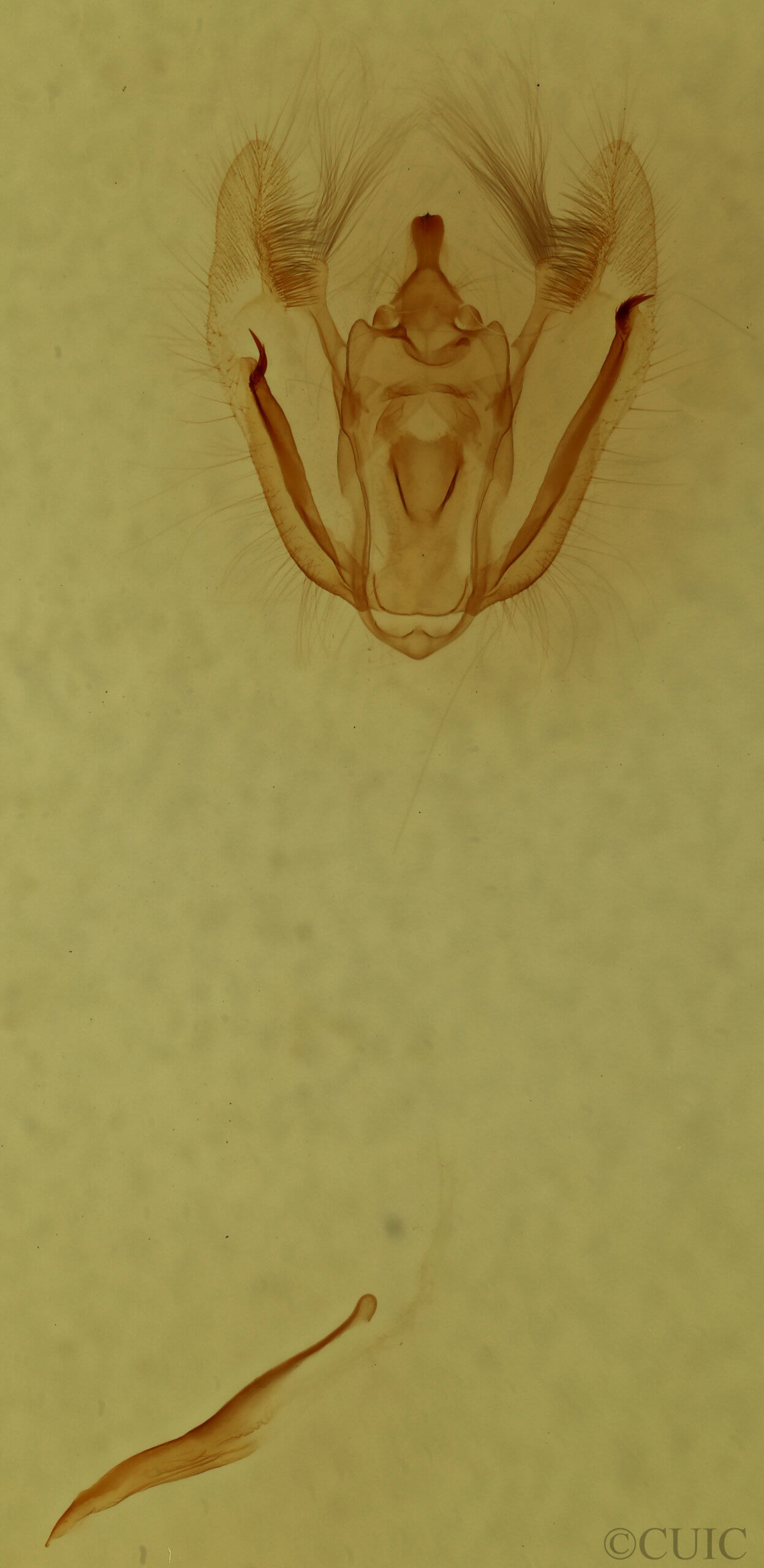 genitalia view of adult Melanolophia canadaria