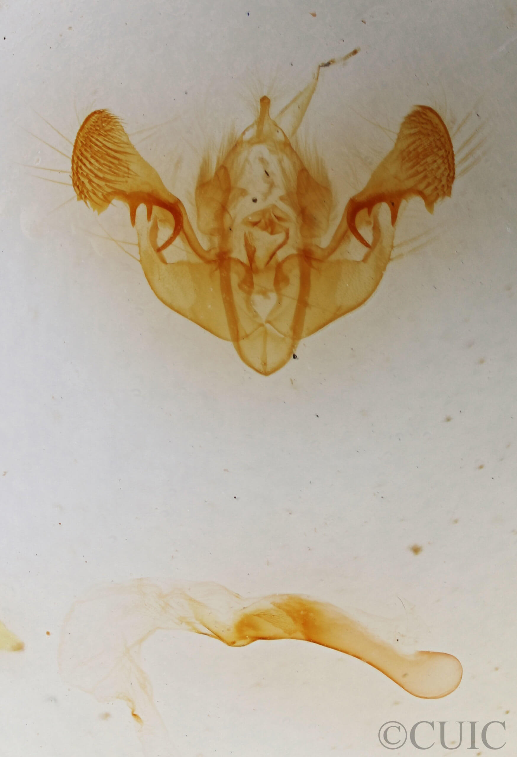 genitalia view of adult Mesapamea fractilinea