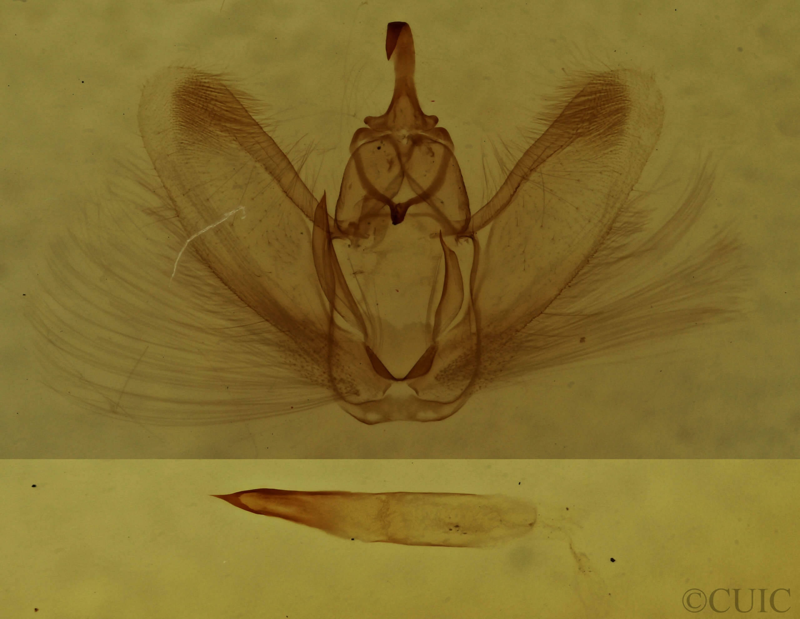 genitalia view of adult Metarranthis warneri