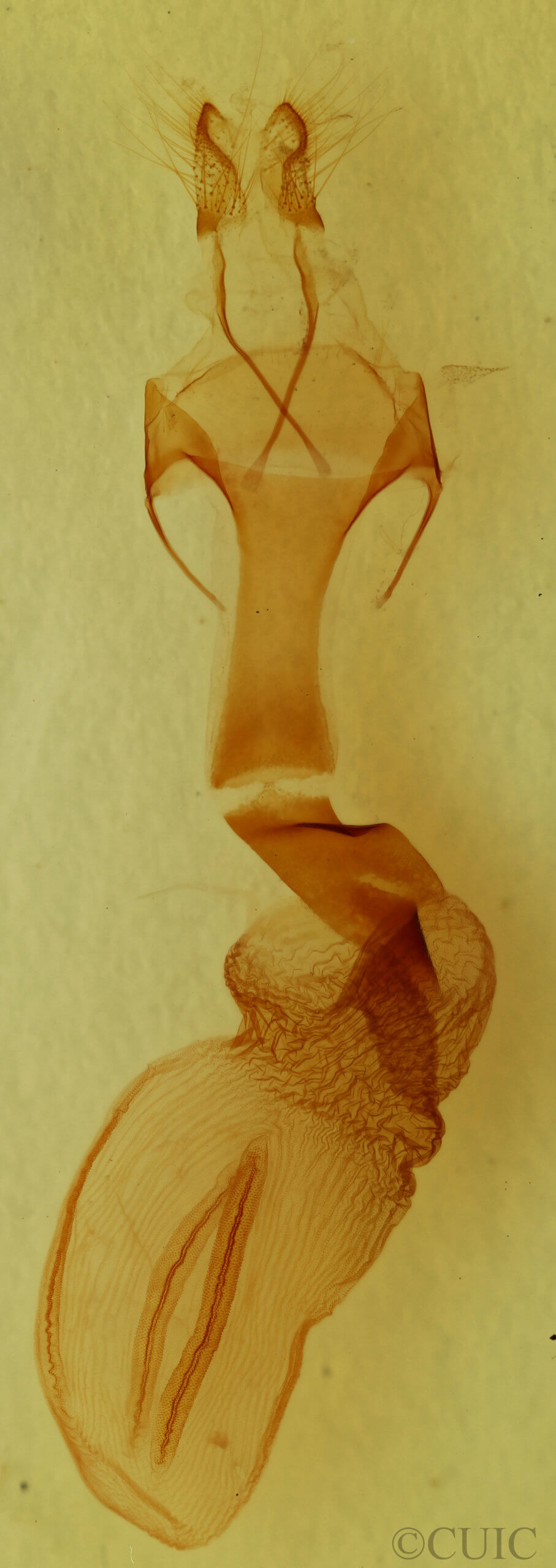 genitalia view of adult Metaxaglaea inulta