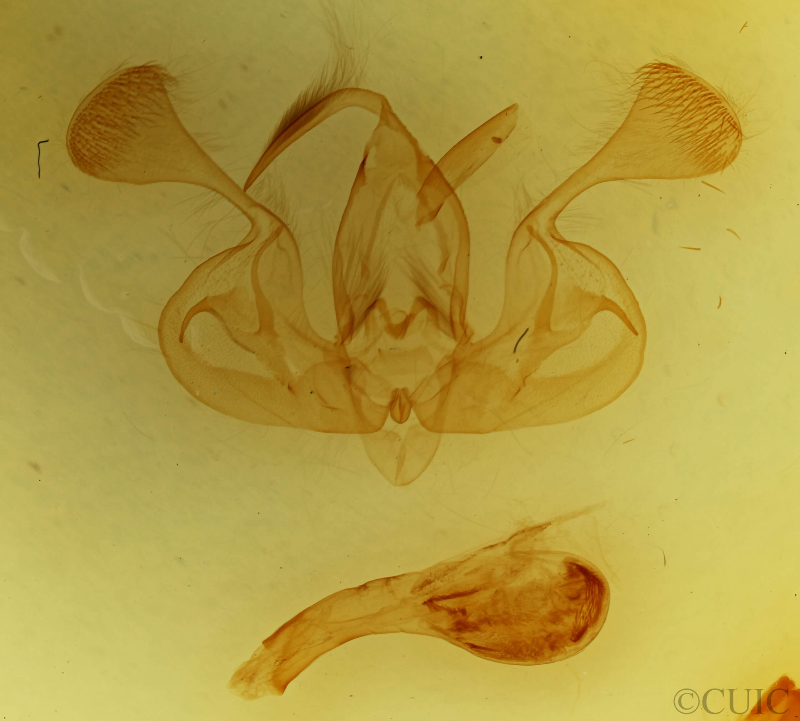 genitalia view of adult Mythimna turca