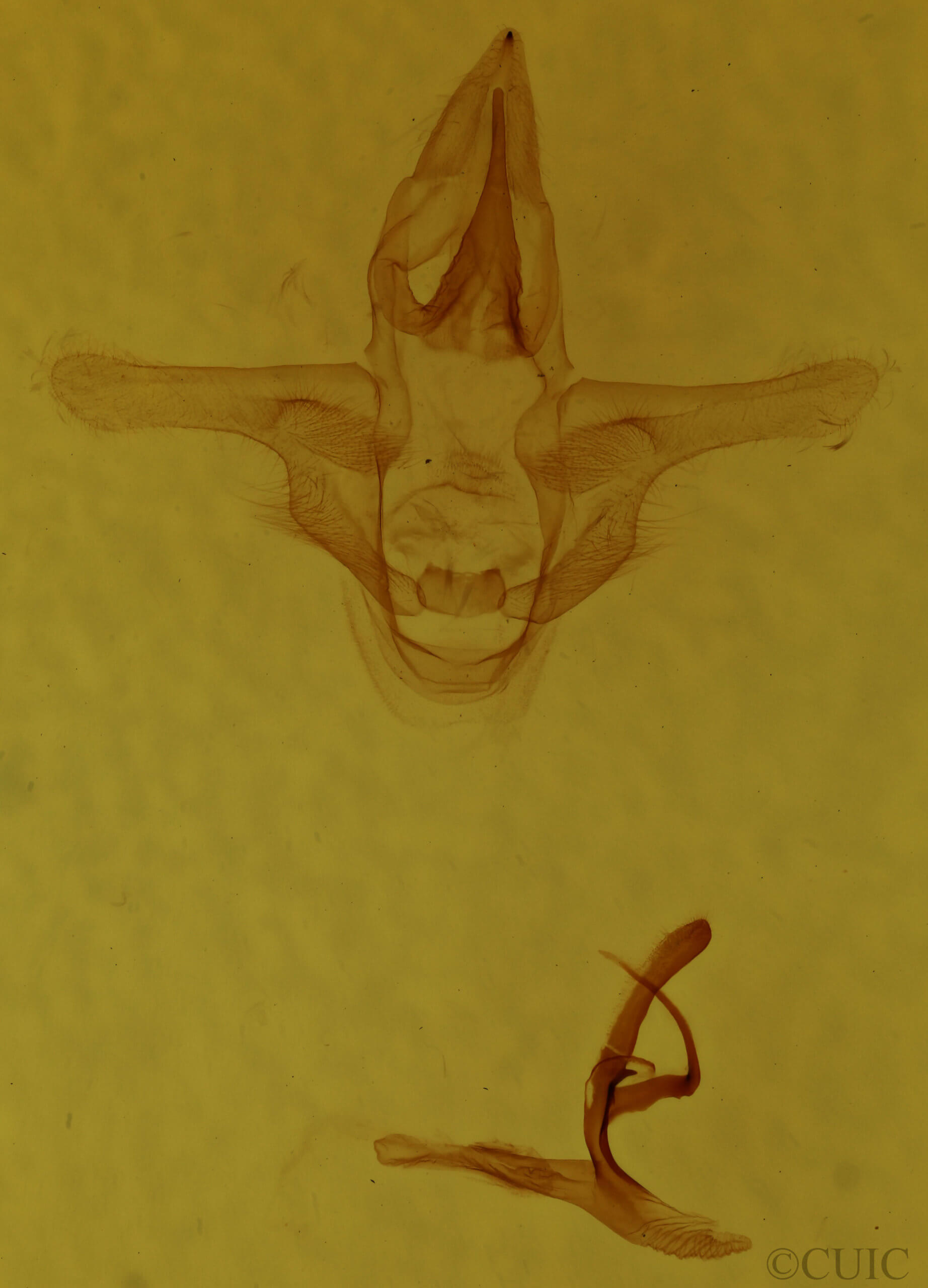 genitalia view of adult Natada nasoni