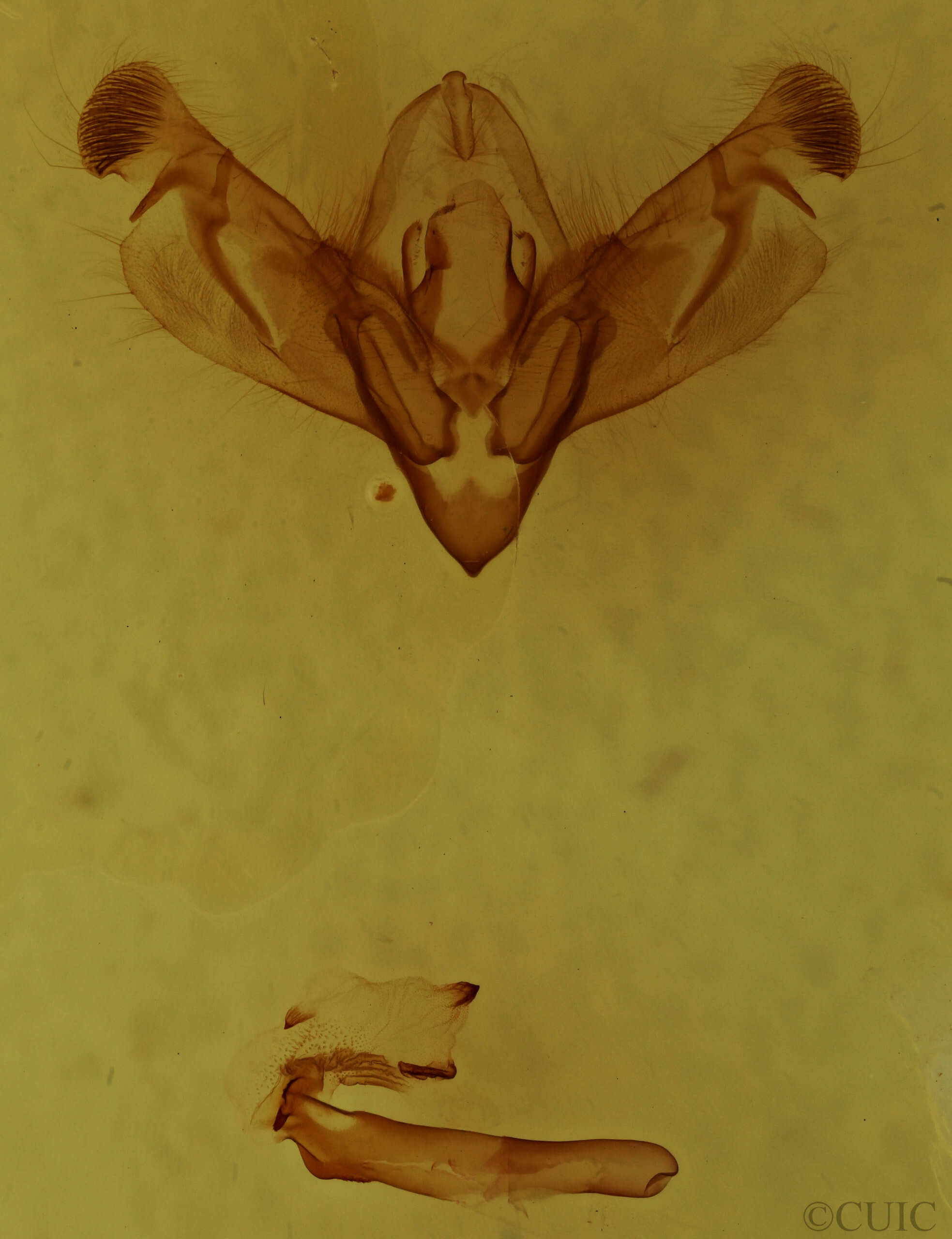 genitalia view of adult Nedra ramulosa