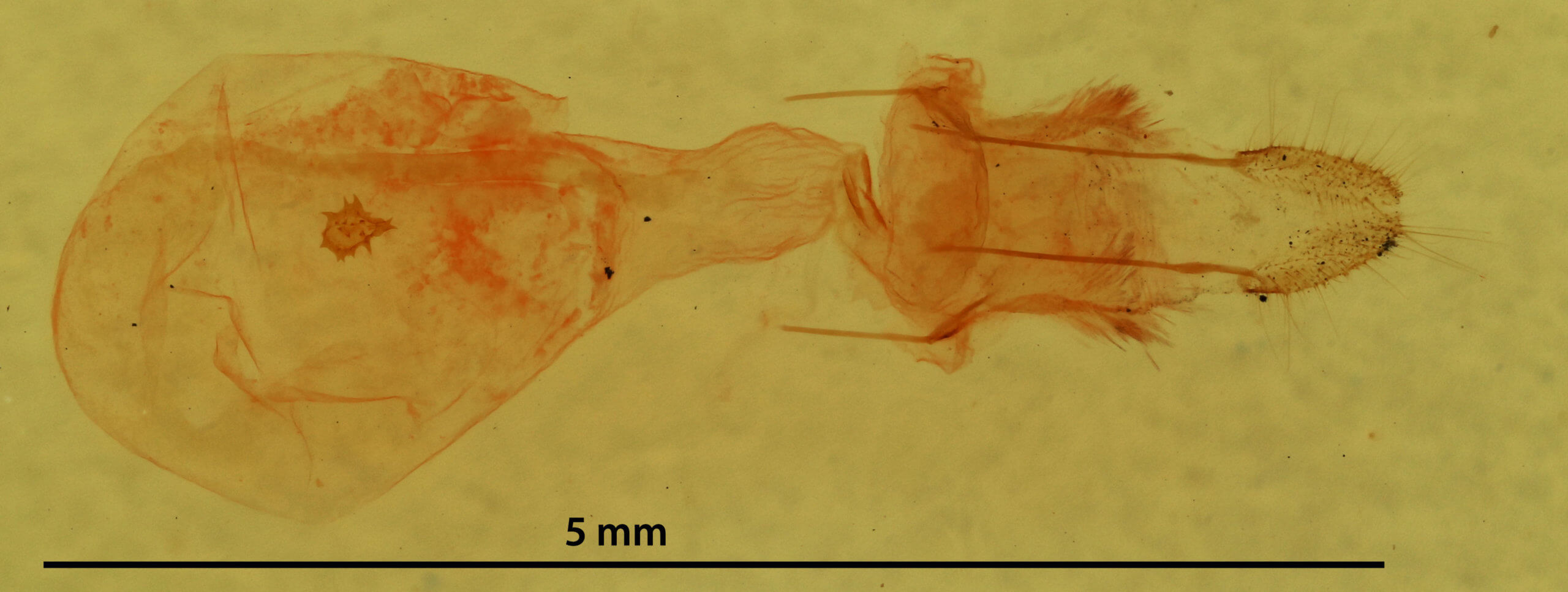 genitalia view of adult Nepytia canosaria