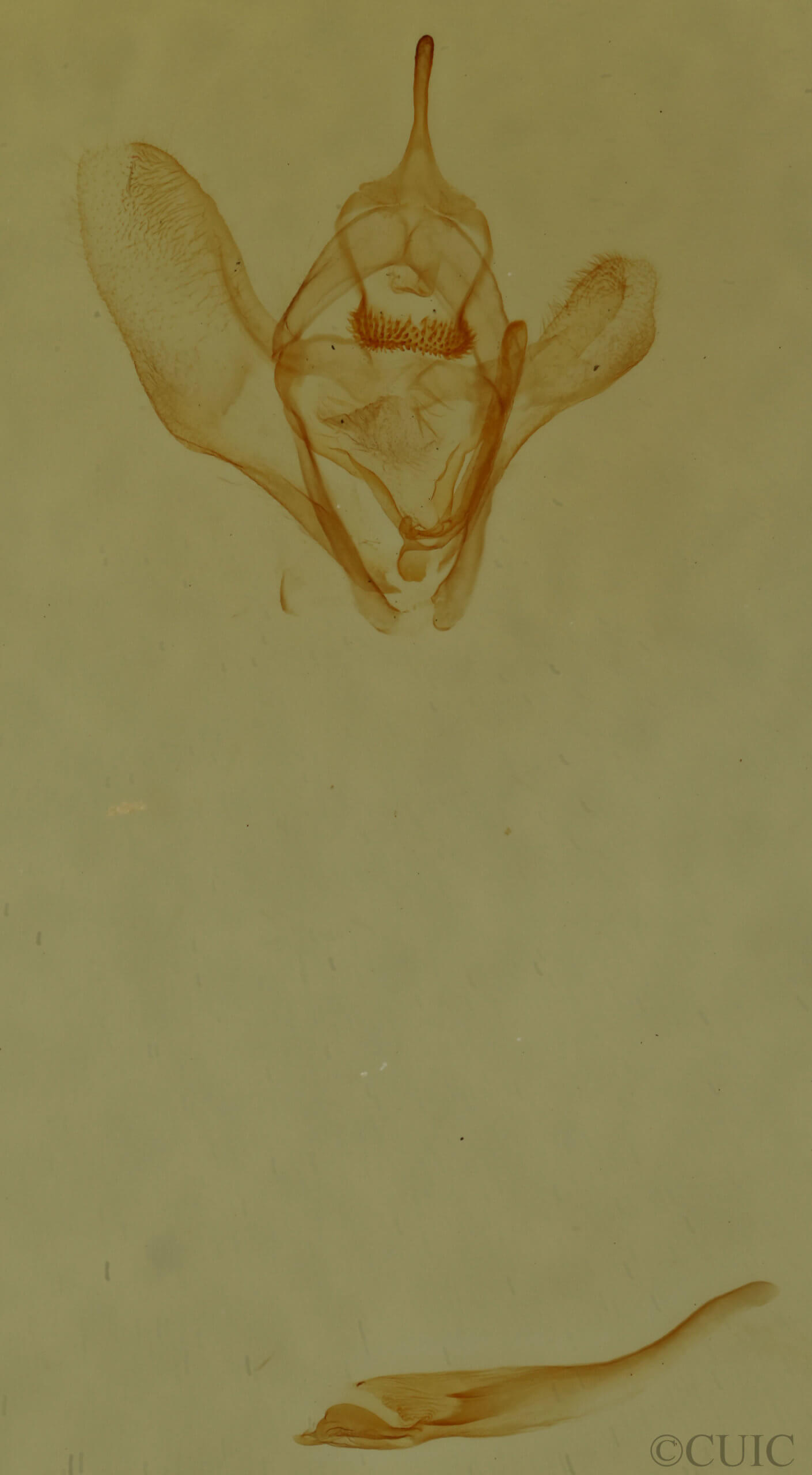 genitalia view of adult Nepytia canosaria