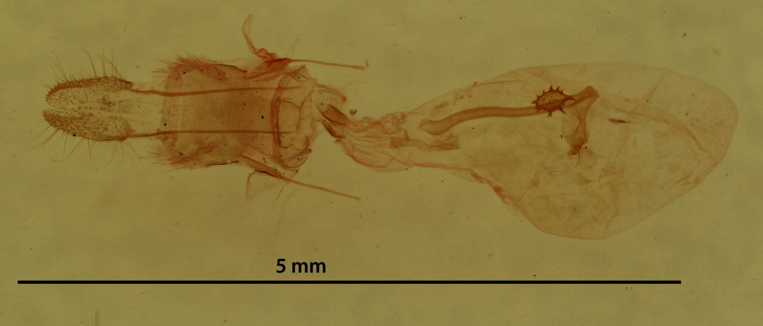 genitalia view of adult Nepytia canosaria