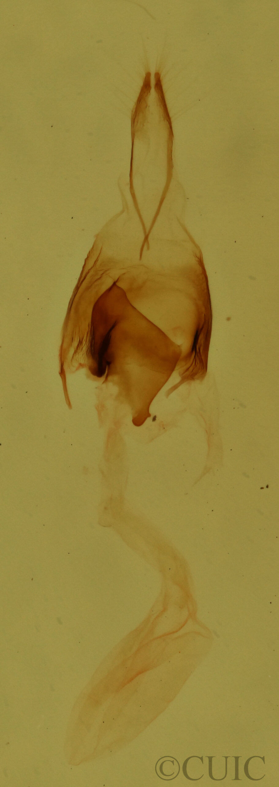 genitalia view of adult Nola cilicoides