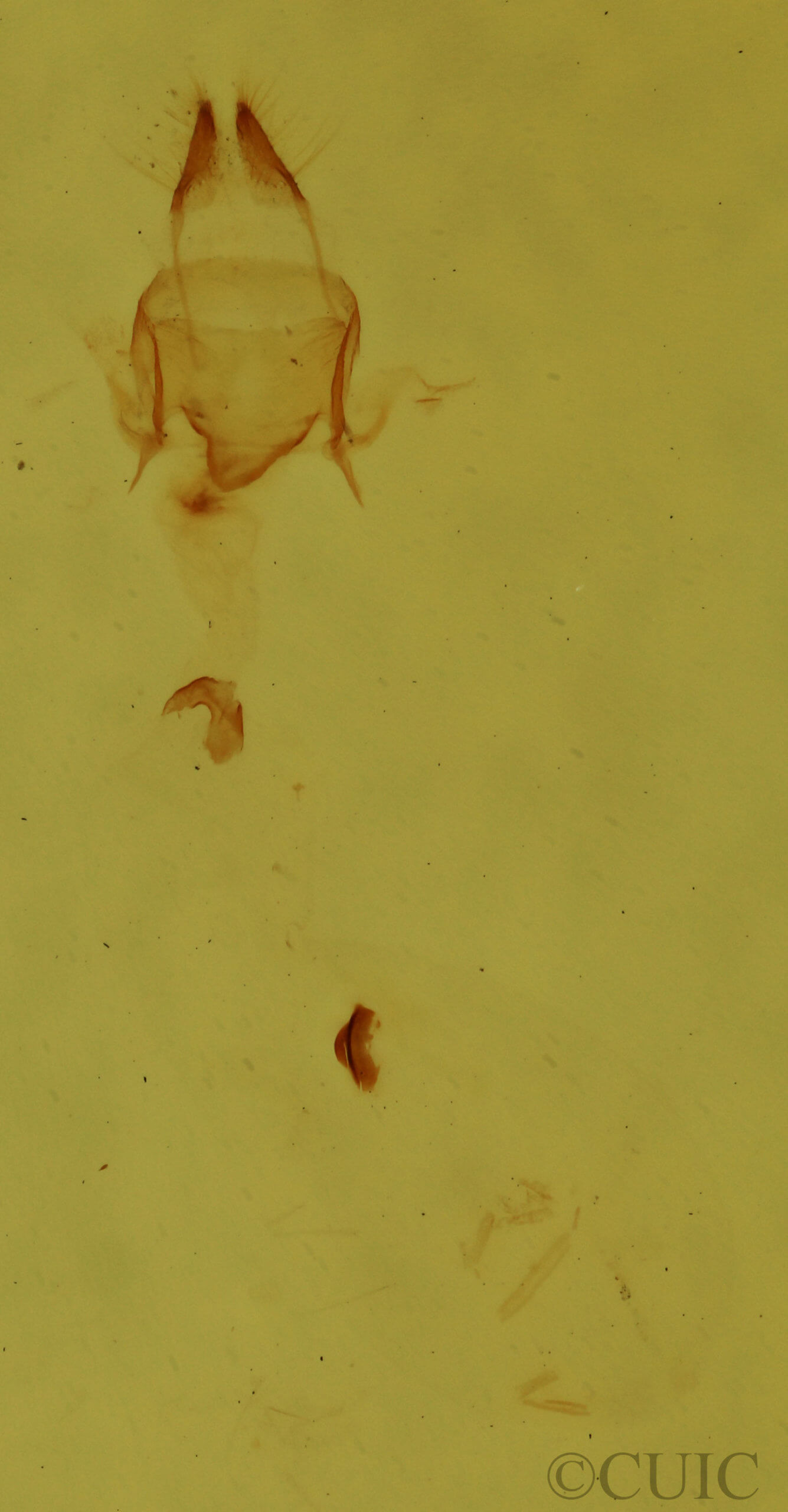 genitalia view of adult Nola clethrae