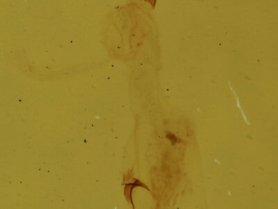 genitalia view of adult Nola pustulata