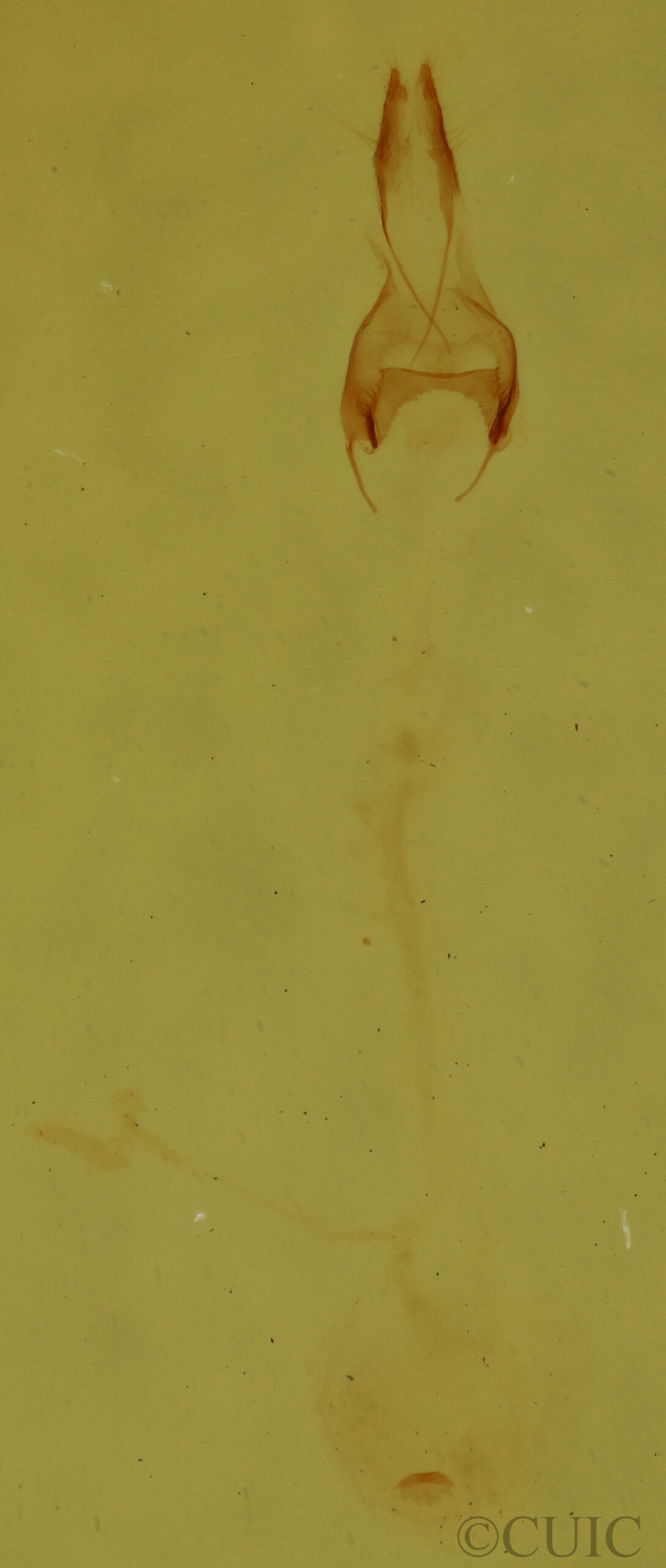 genitalia view of adult Nola cereella