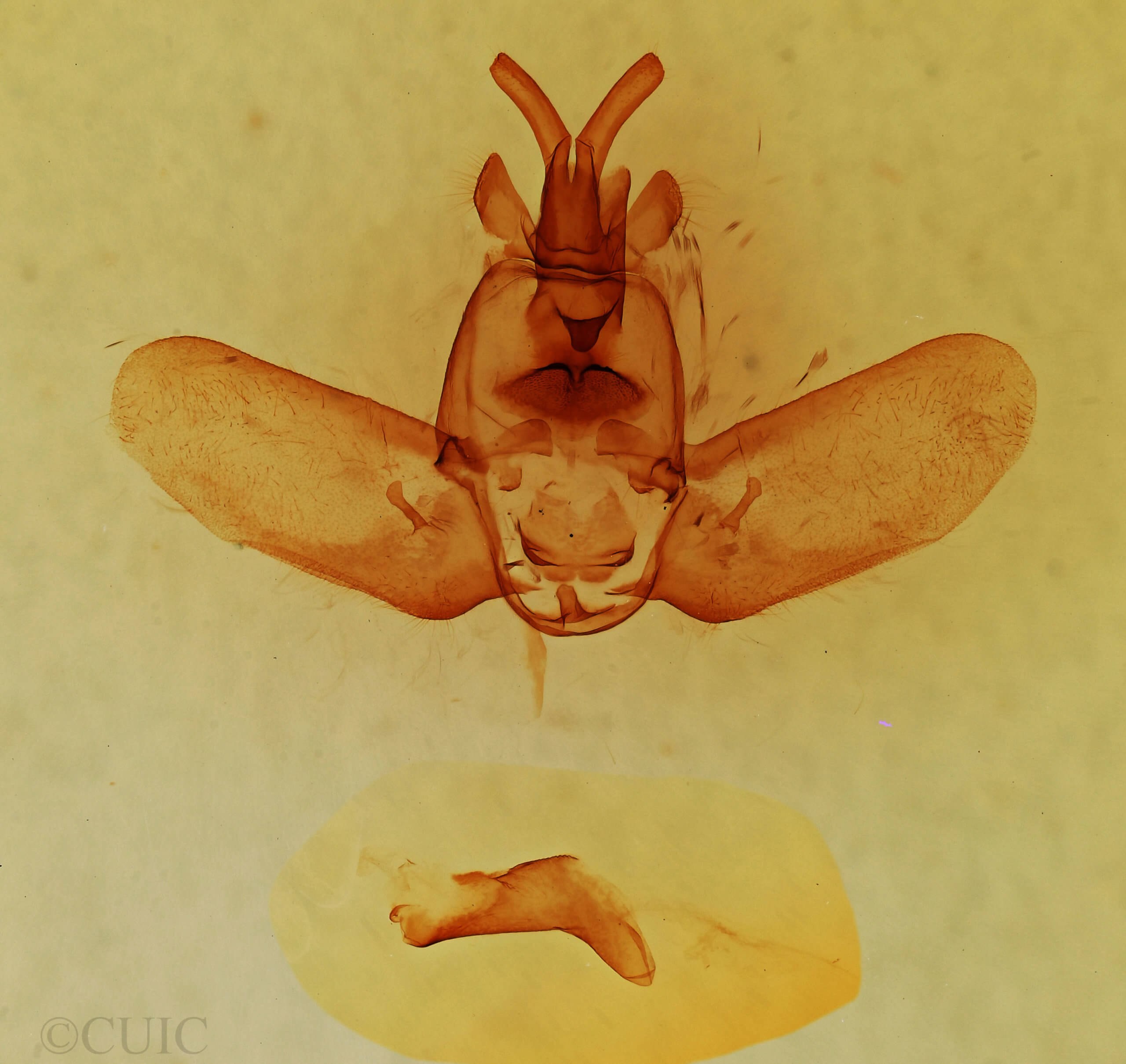 genitalia view of adult Olceclostera angelica