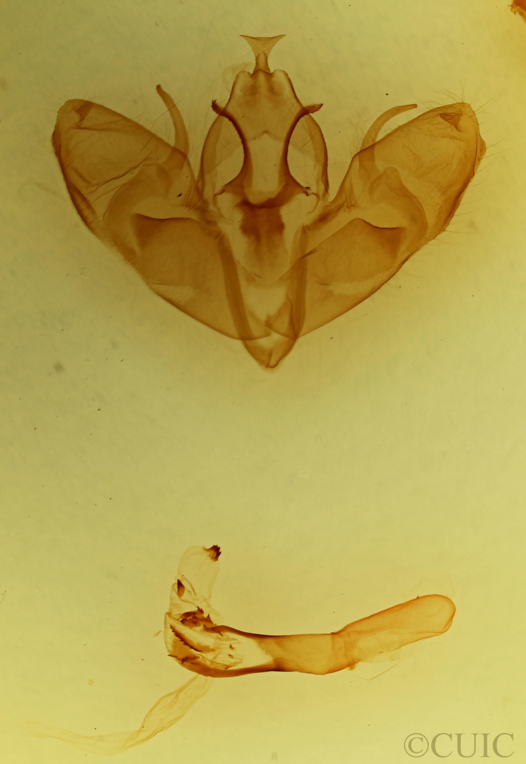 genitalia view of adult Orthosia gothica