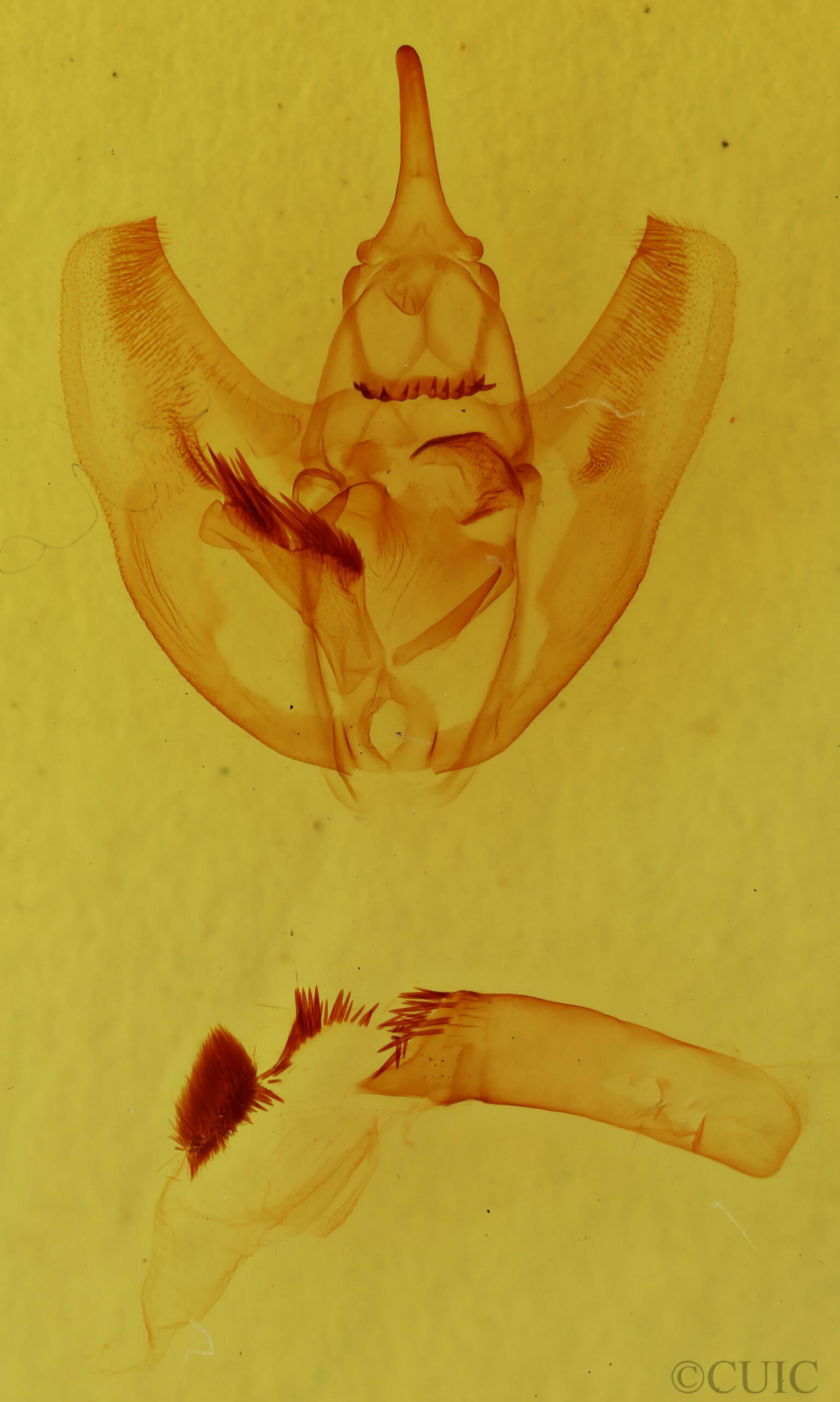 genitalia view of adult Oxydia vesulia