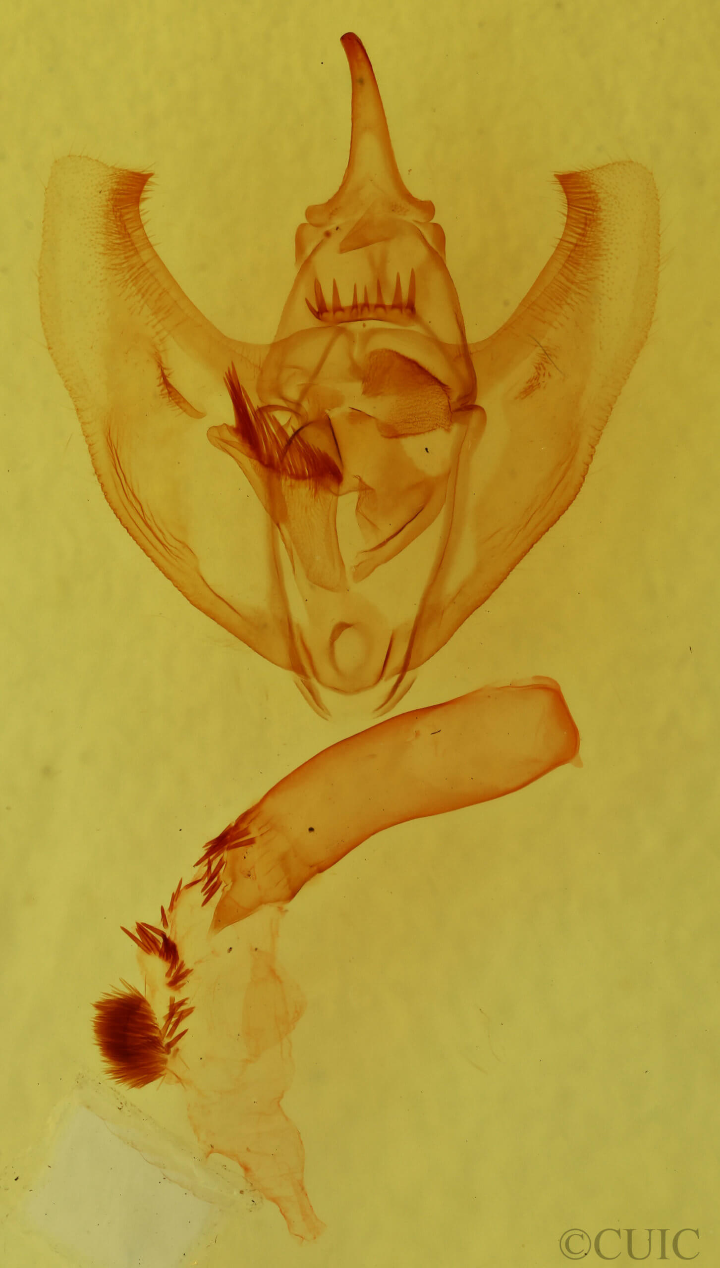 genitalia view of adult Oxydia vesulia