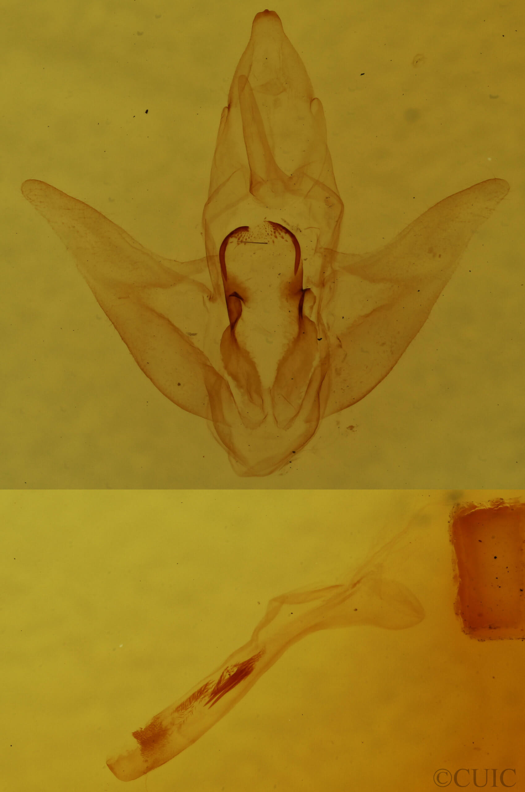 genitalia view of adult Parasa indetermina