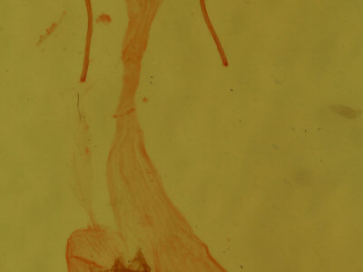 genitalia view of adult Perigea xanthioides