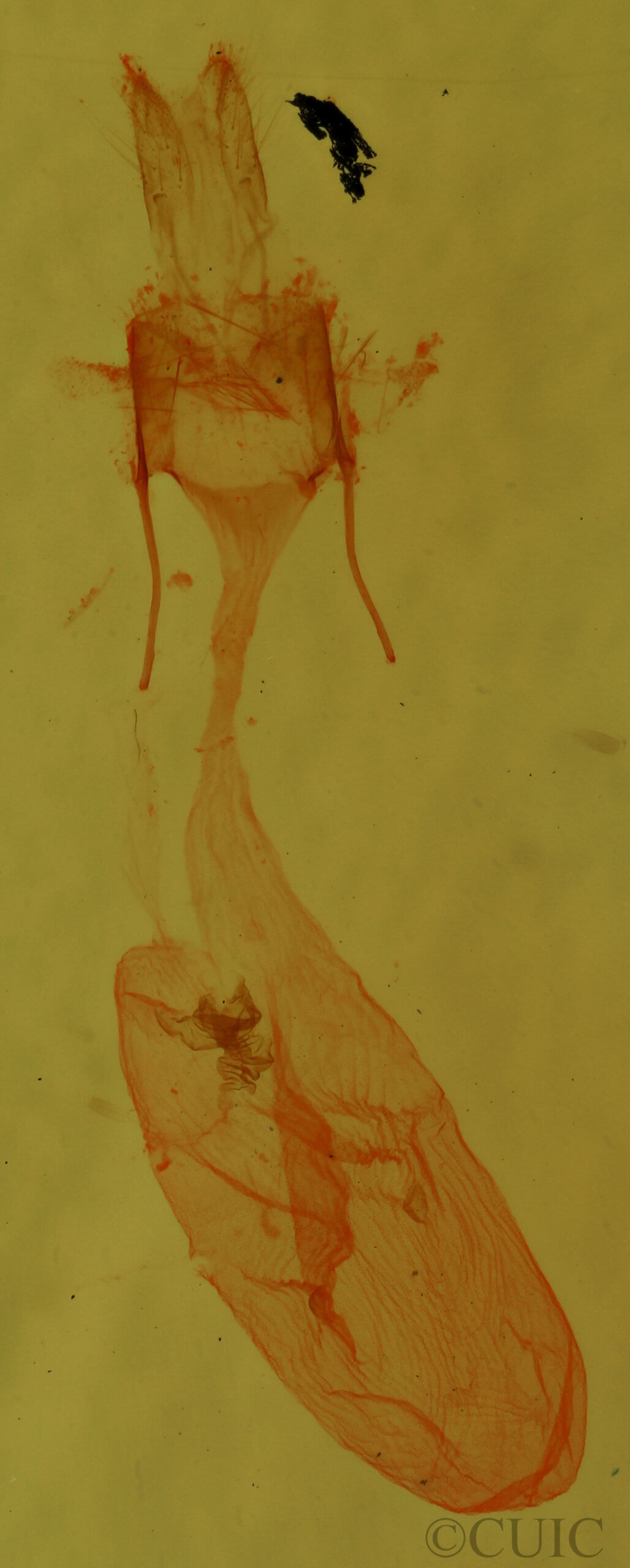 genitalia view of adult Perigea xanthioides