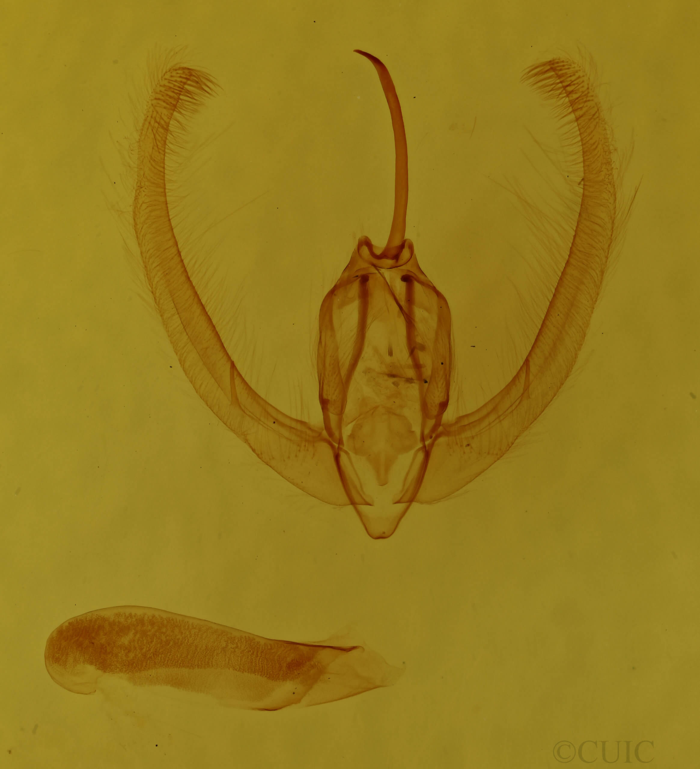 genitalia view of adult Condica mobilis