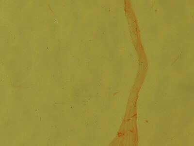 genitalia view of adult Condica mobilis