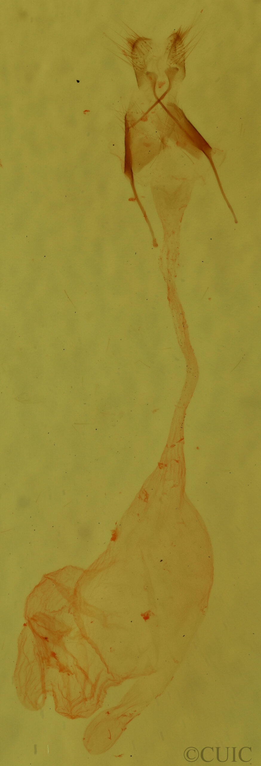 genitalia view of adult Condica mobilis