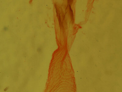 genitalia view of adult Condica vecors