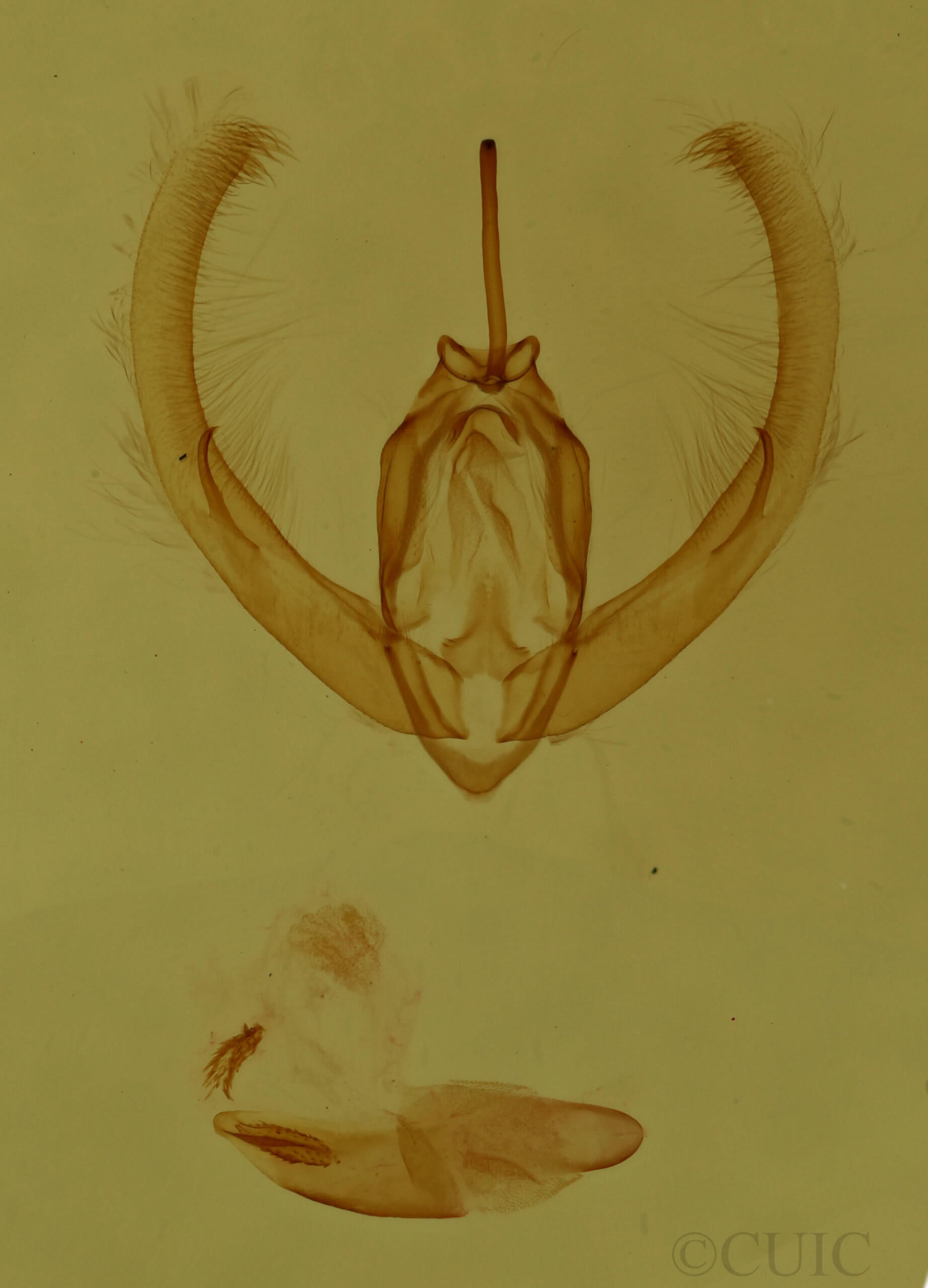 genitalia view of adult Condica videns