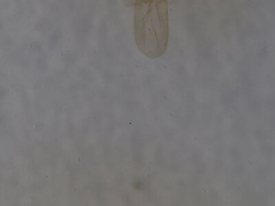 genitalia view of adult Renia nemoralis