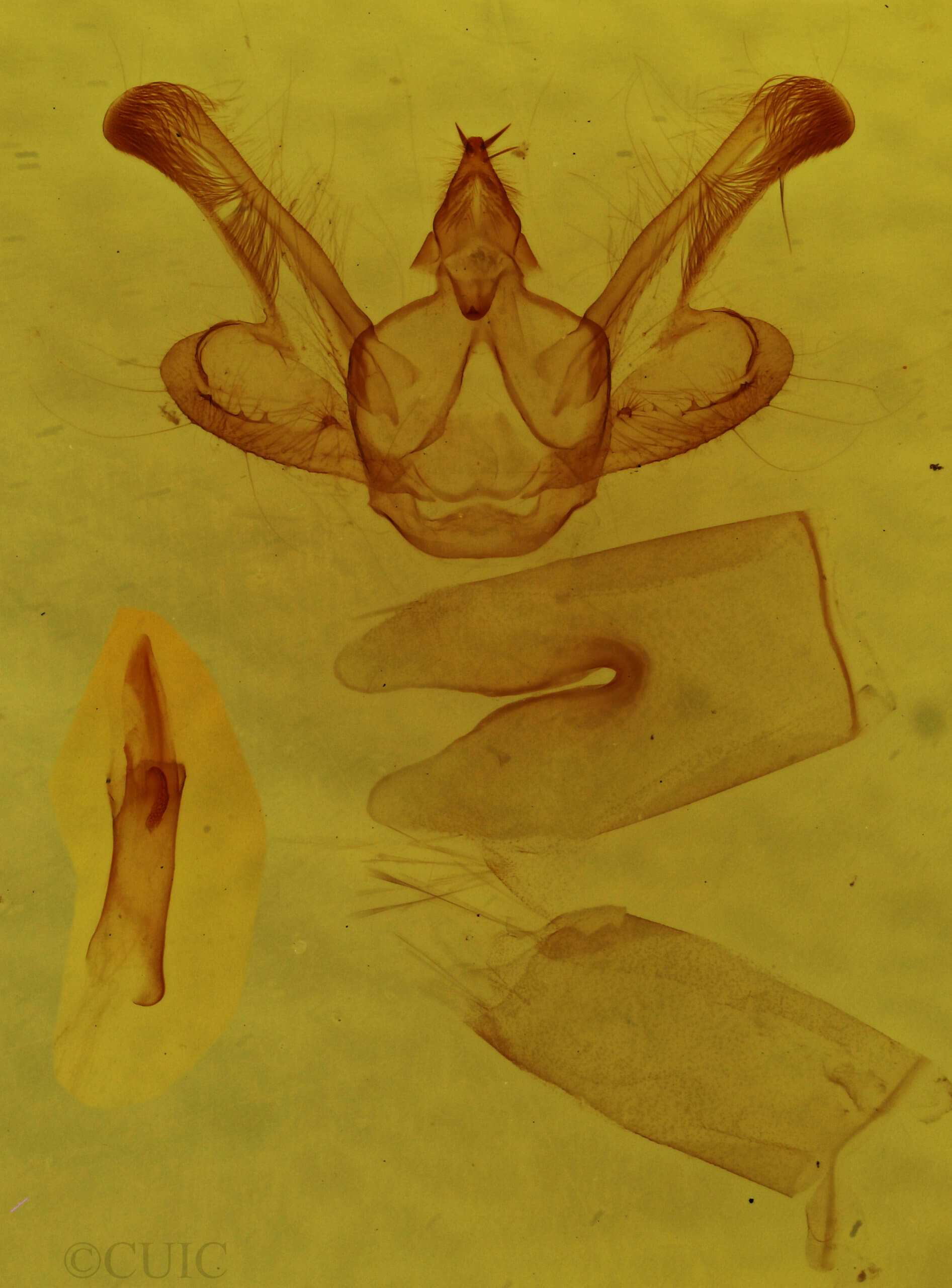 genitalia view of adult Macaria transitaria