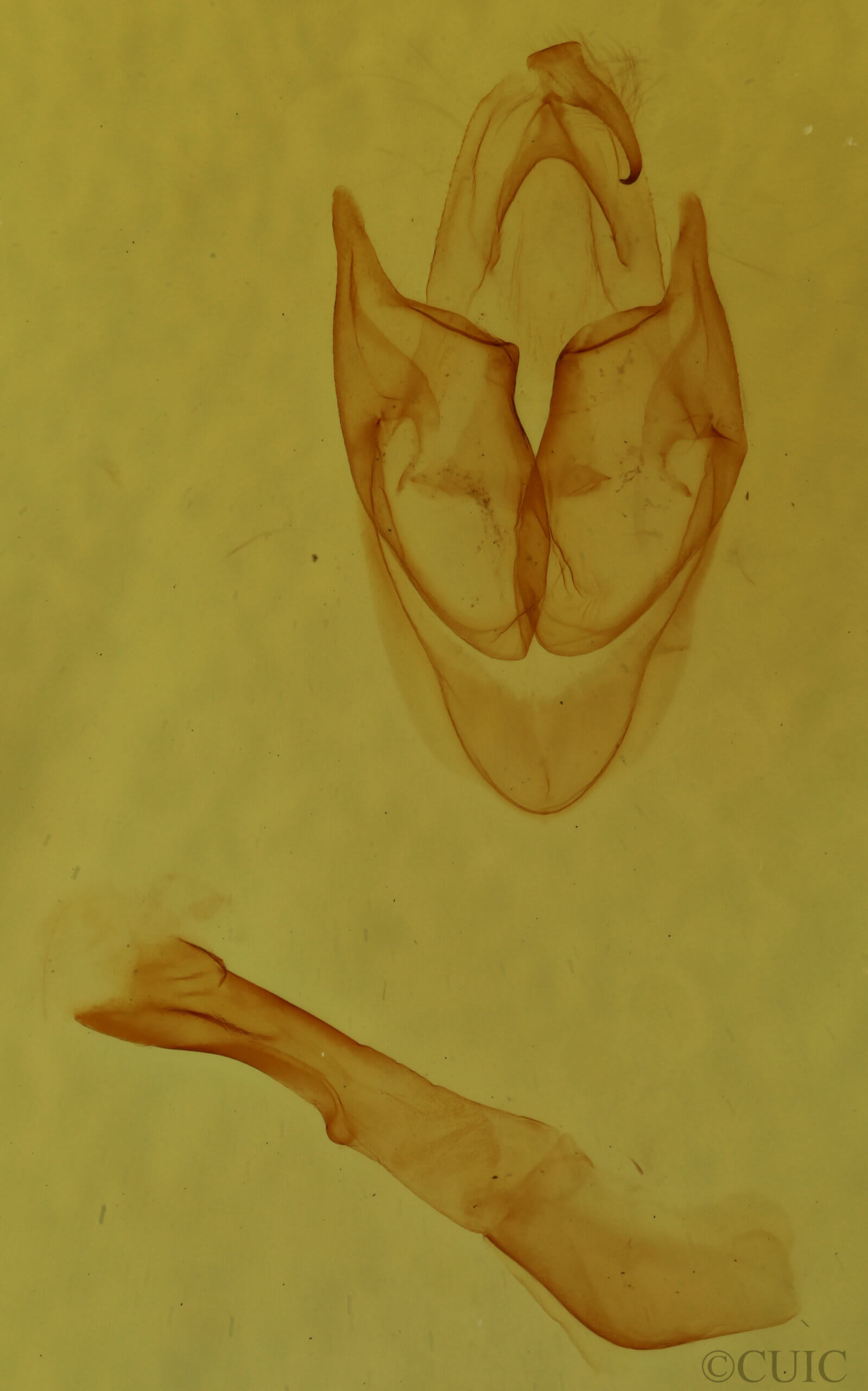 genitalia view of adult Sosxetra grata