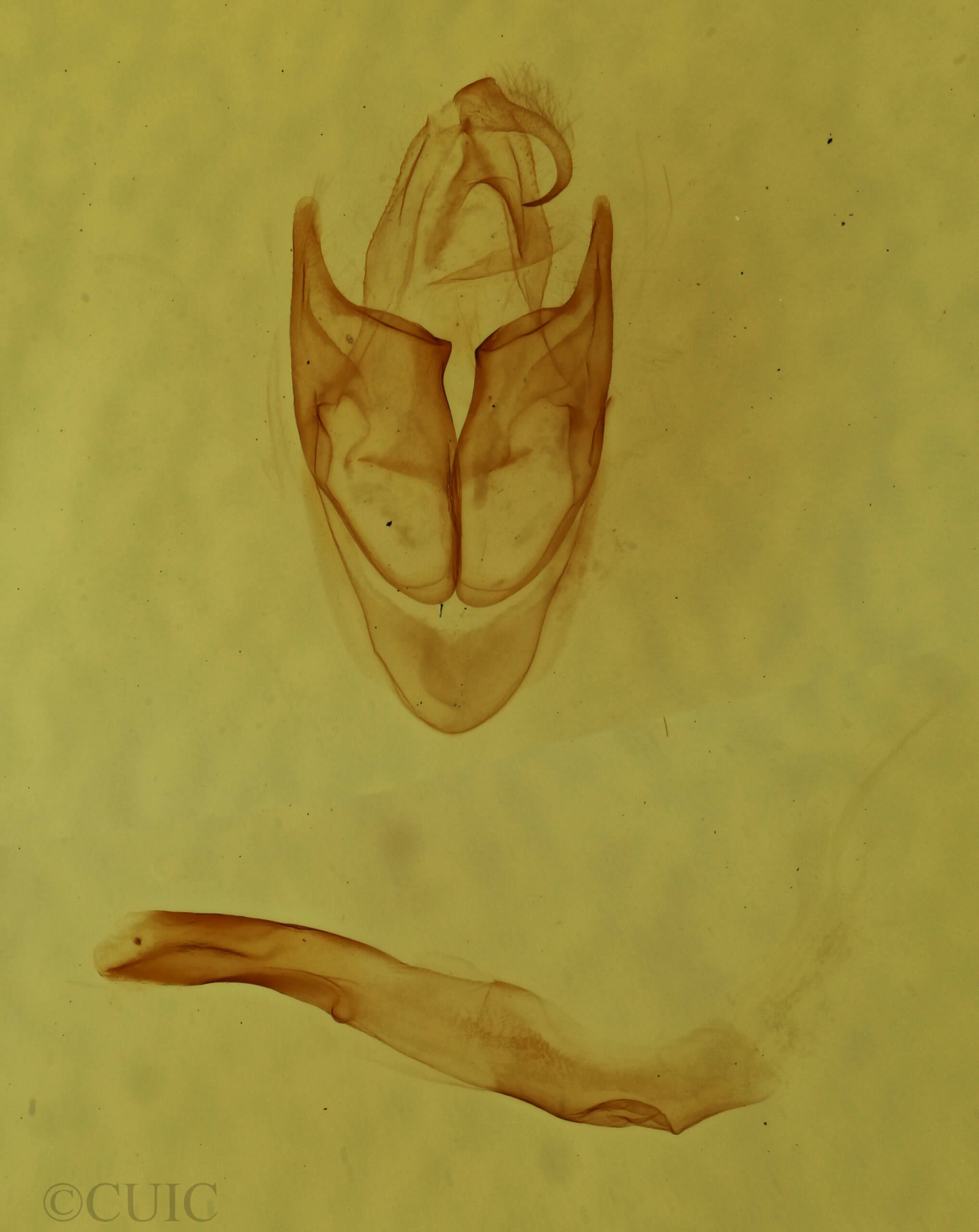 genitalia view of adult Sosxetra grata