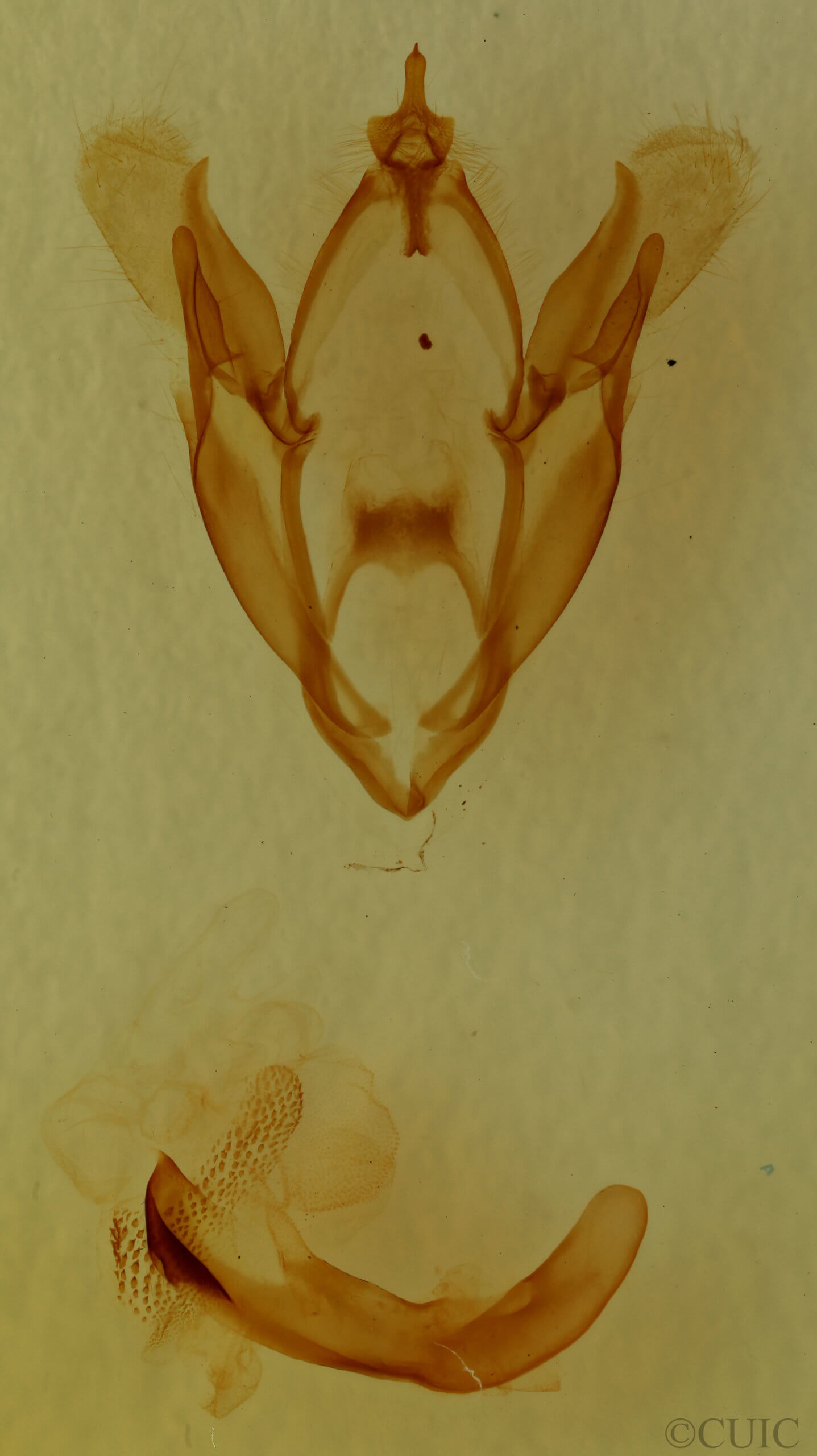 genitalia view of adult Spiloloma lunilinea