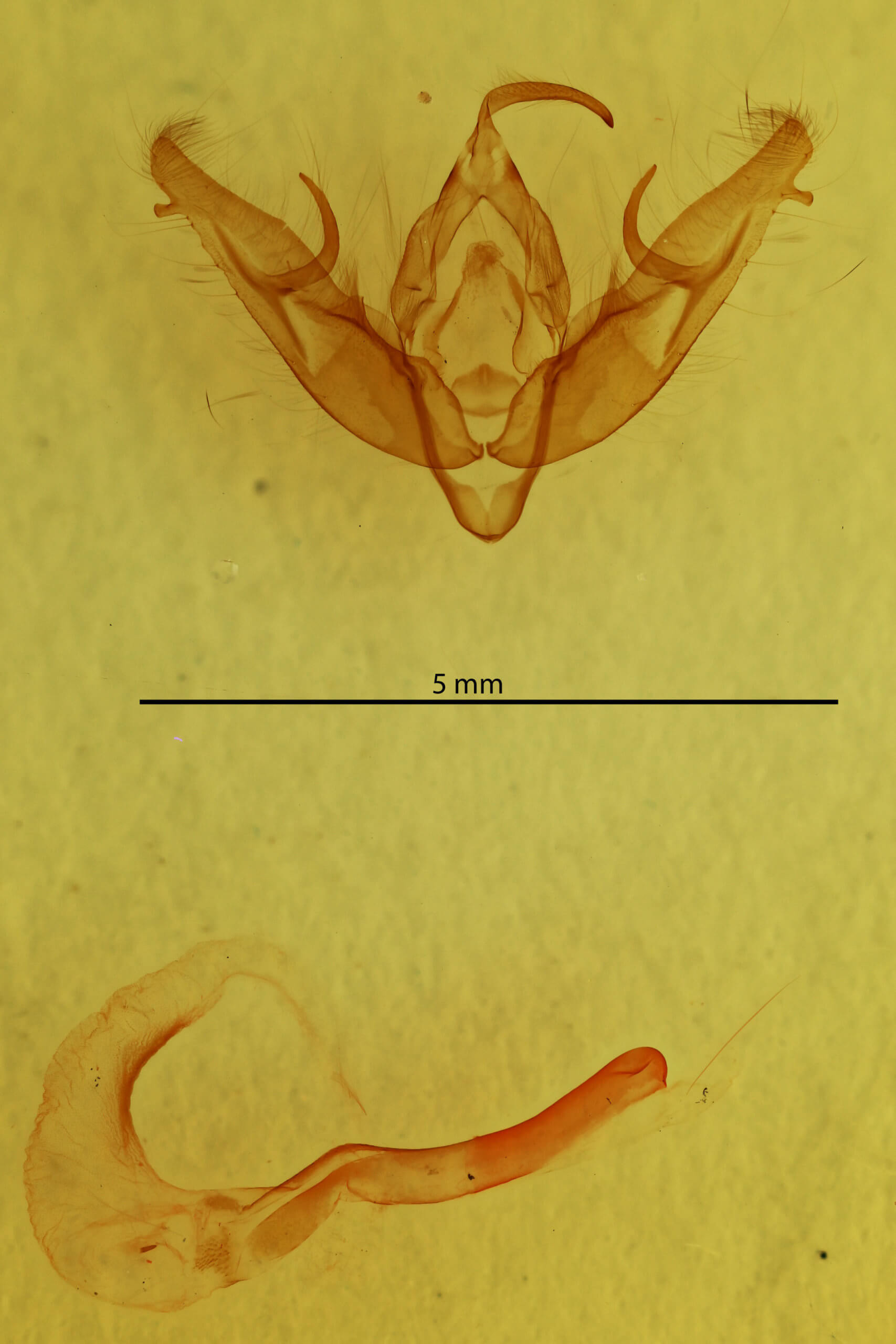 genitalia view of adult Xestia dilucida