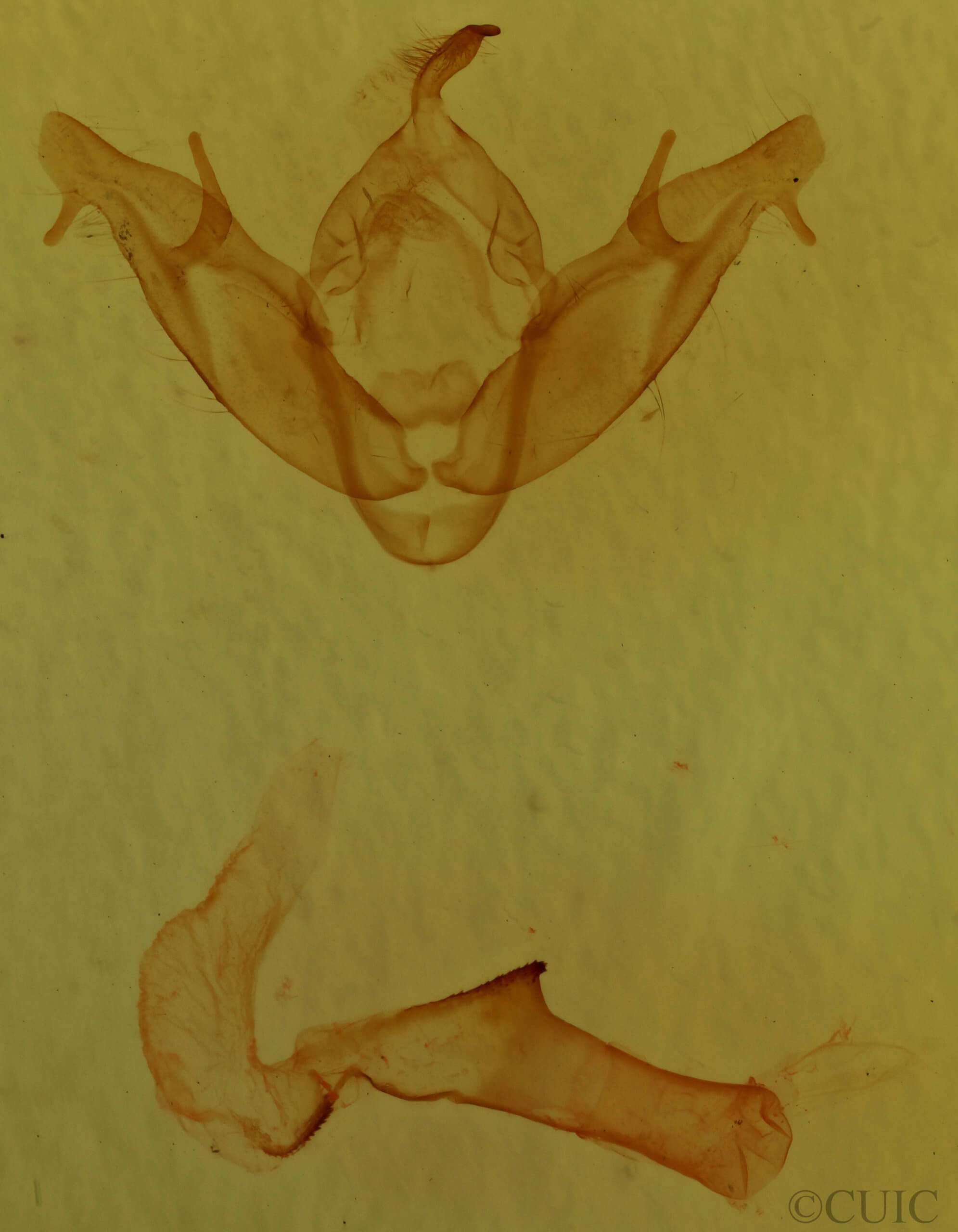 genitalia view of adult Xestia agathina