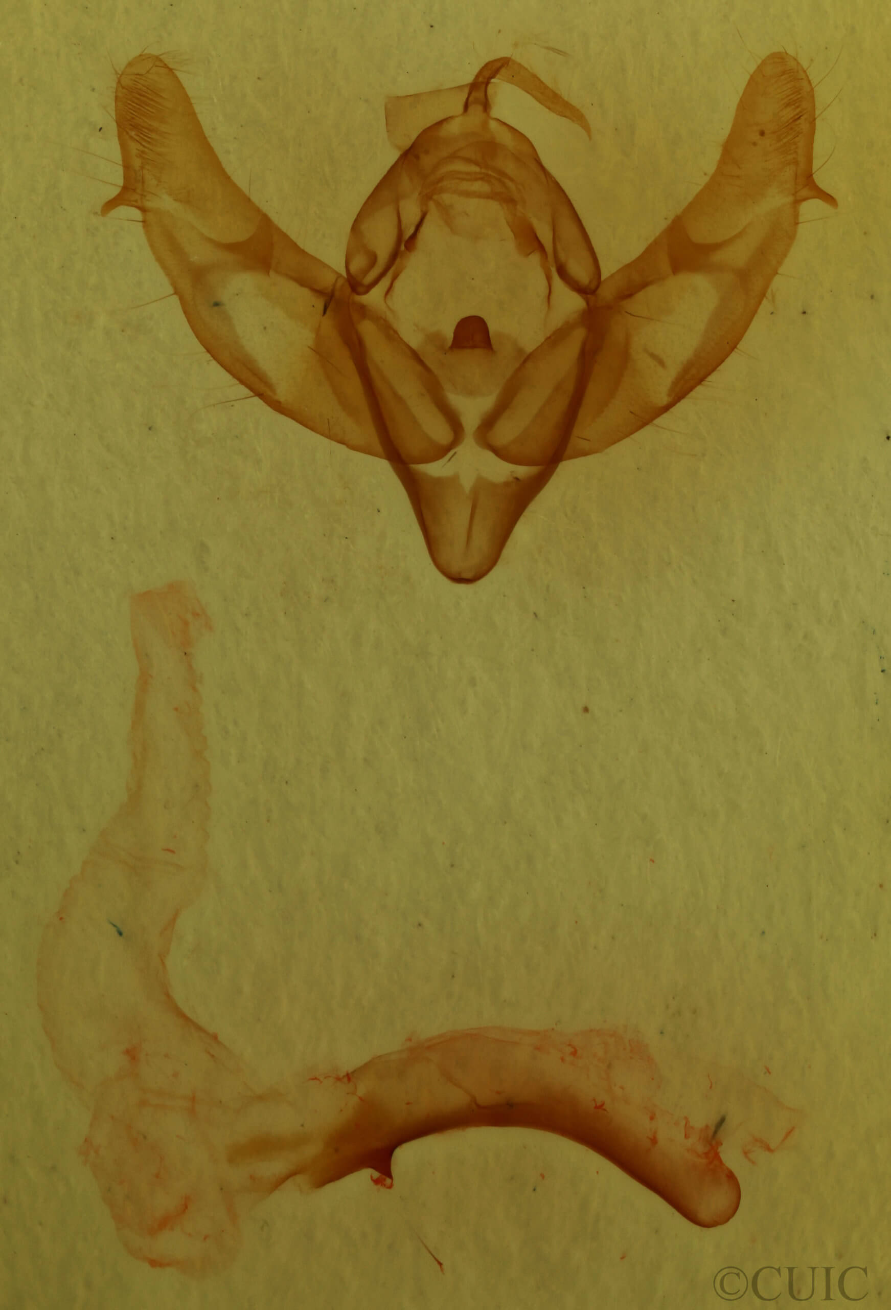 genitalia view of adult Xestia ashworthii