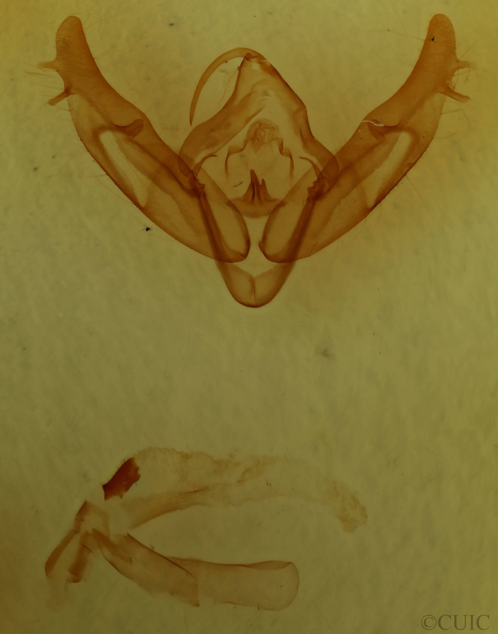 genitalia view of adult Xestia baja