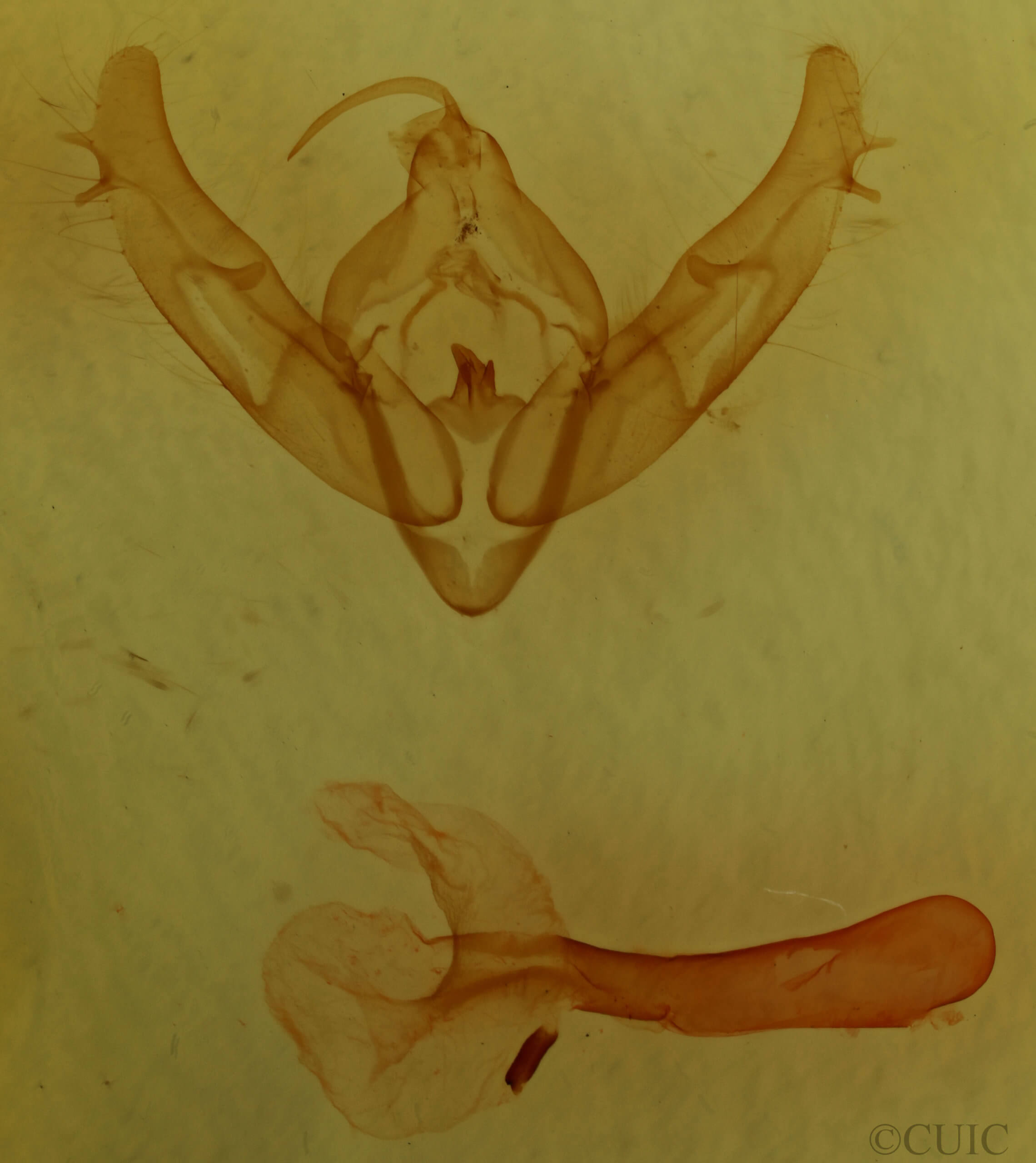 genitalia view of adult Xestia baja