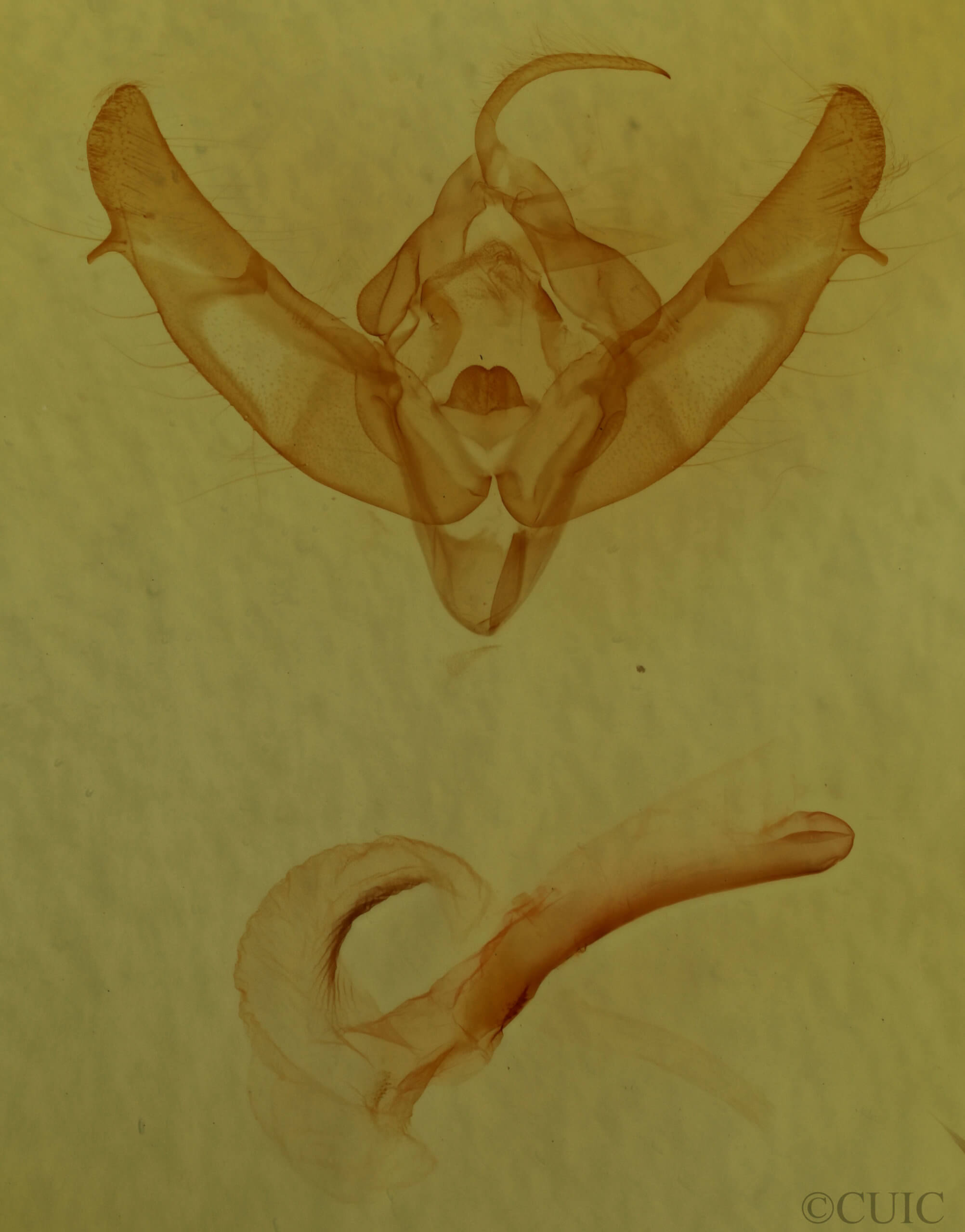 genitalia view of adult Xestia c-nigrum