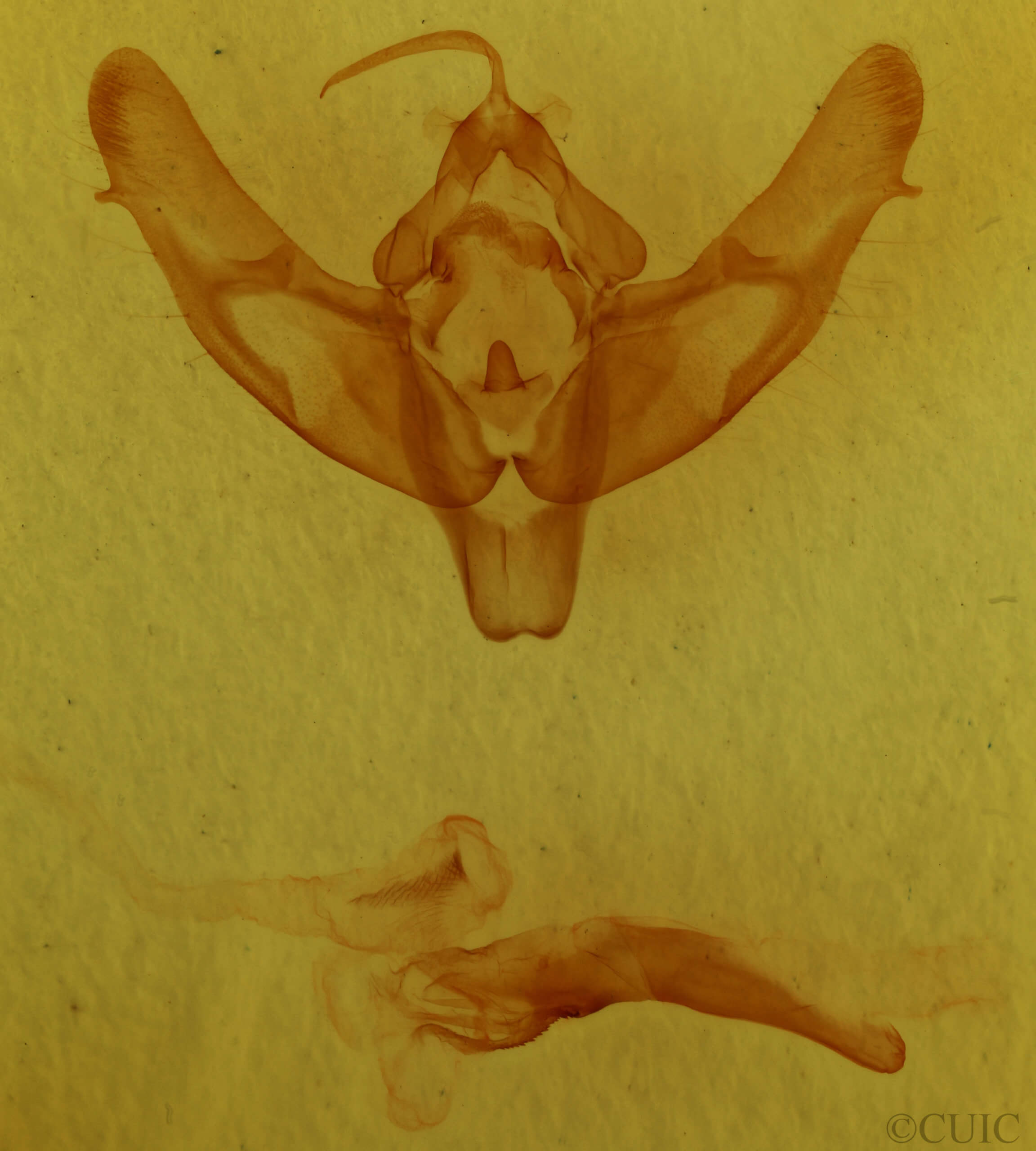 genitalia view of adult Xestia triangulum